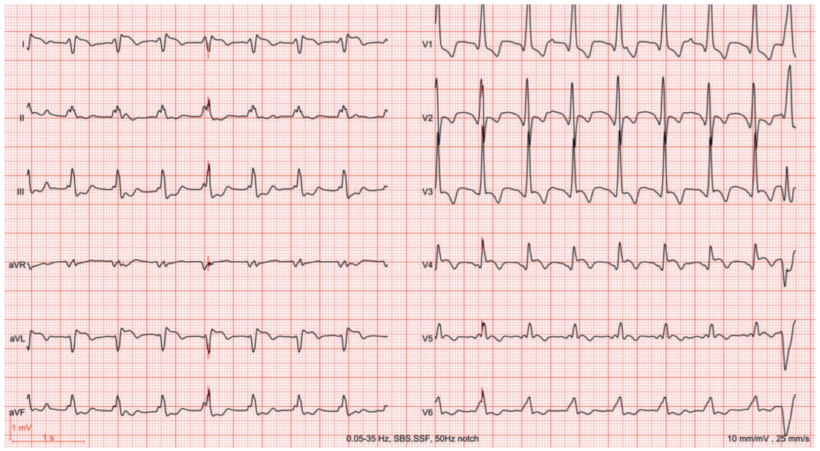 Cardiovascmed 20 00074 g001 Cardiovascmed 20 00074 g001