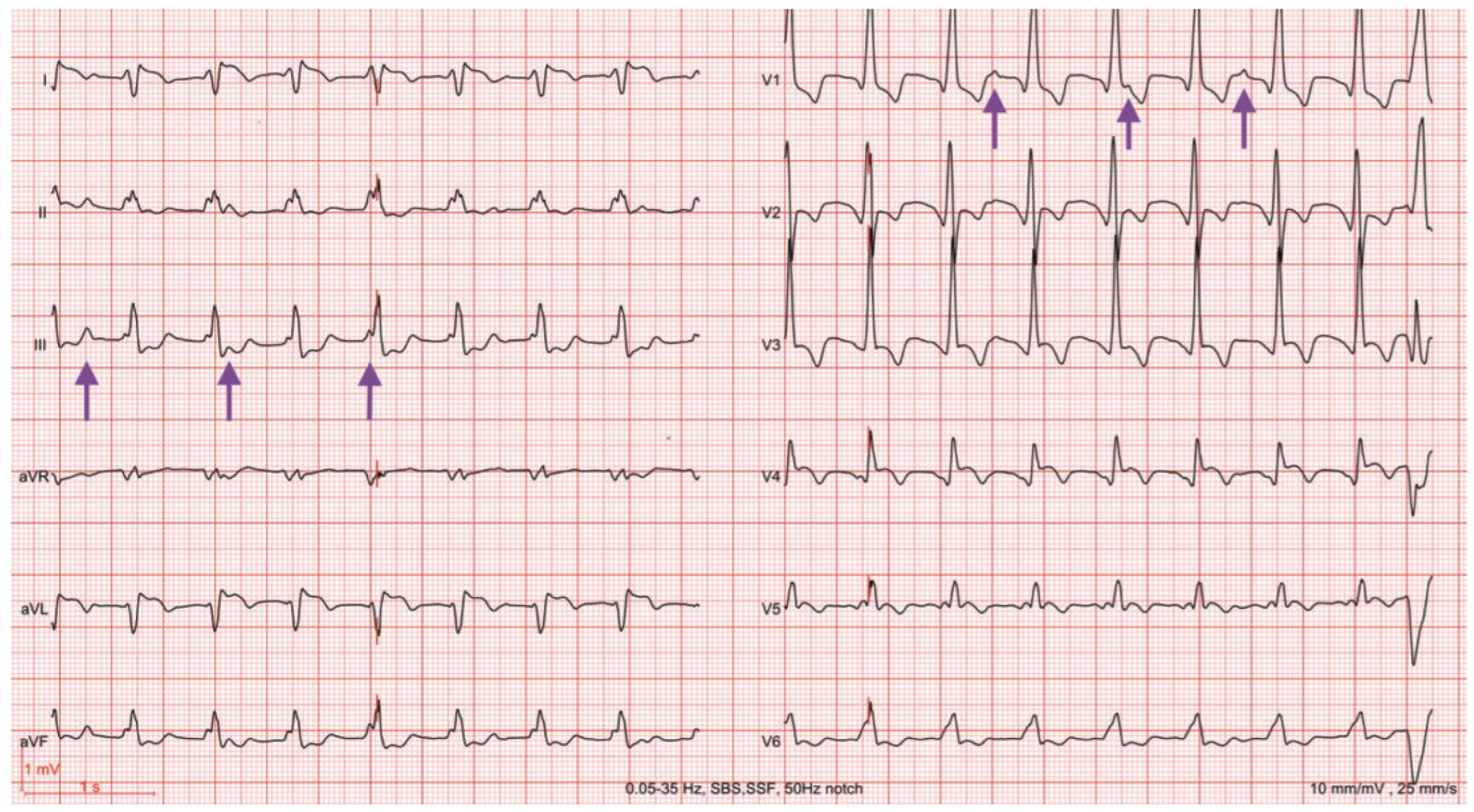Cardiovascmed 20 00074 g002 Cardiovascmed 20 00074 g002
