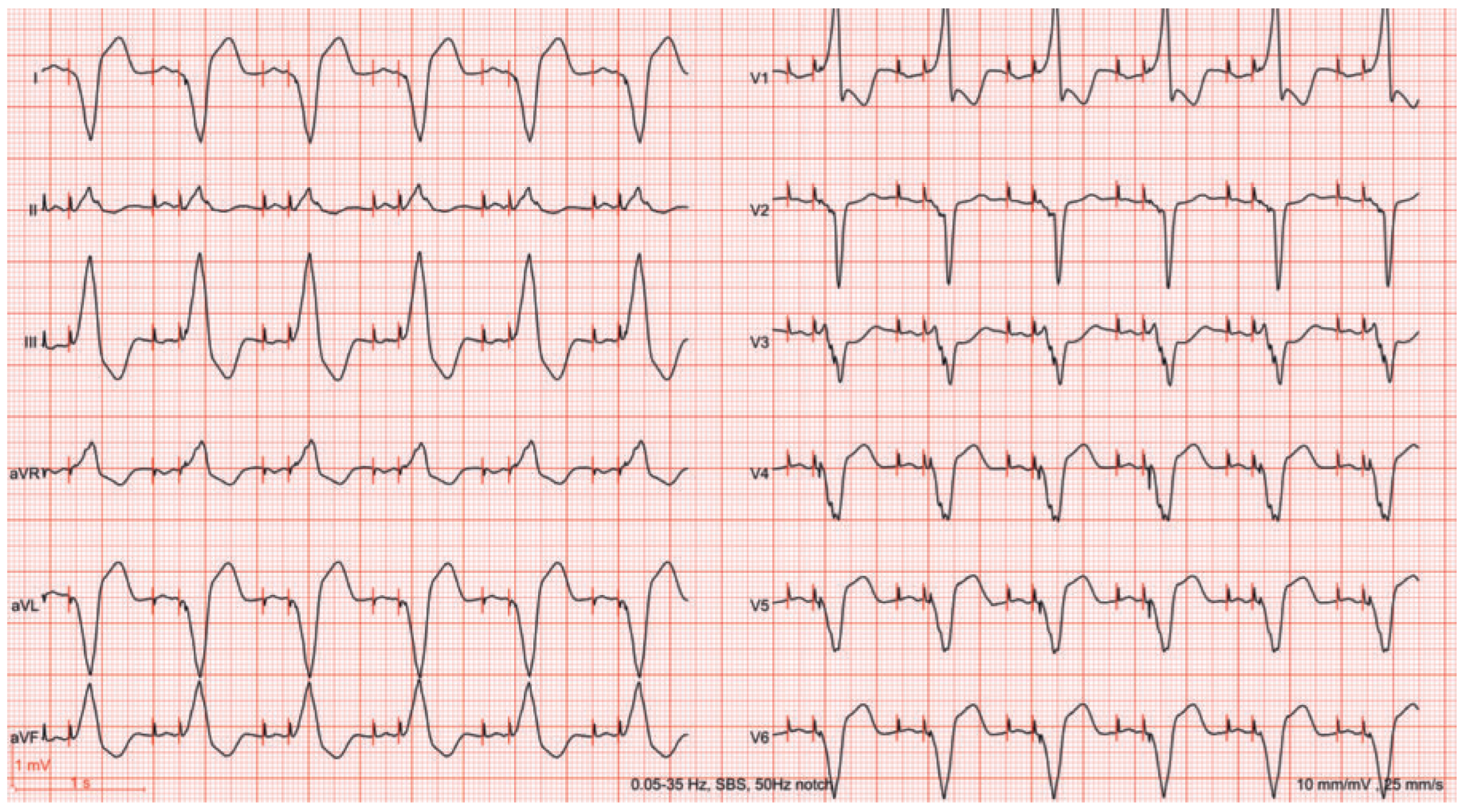 Cardiovascmed 20 00074 g003 Cardiovascmed 20 00074 g003