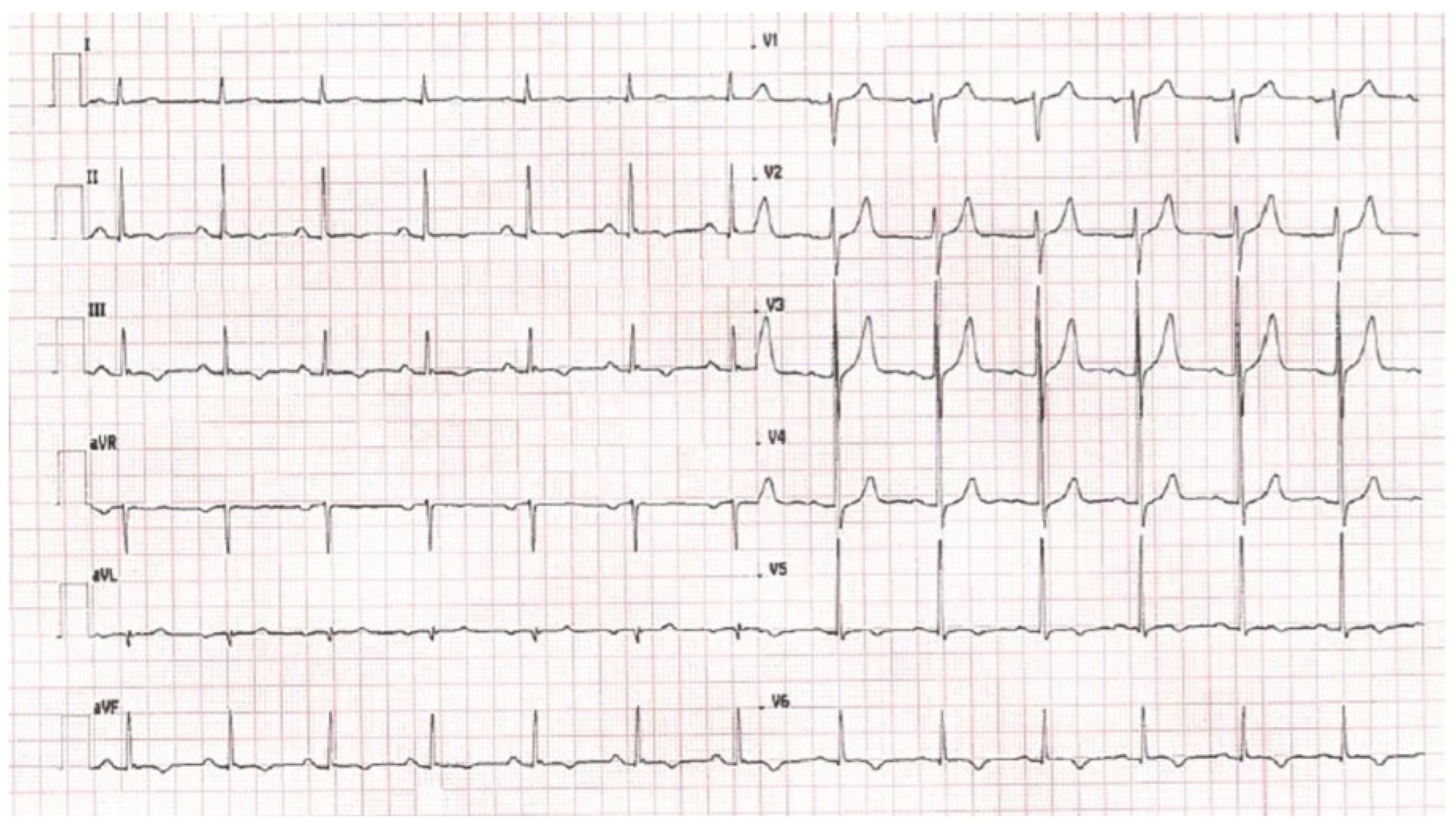Cardiovascmed 20 00105 g001