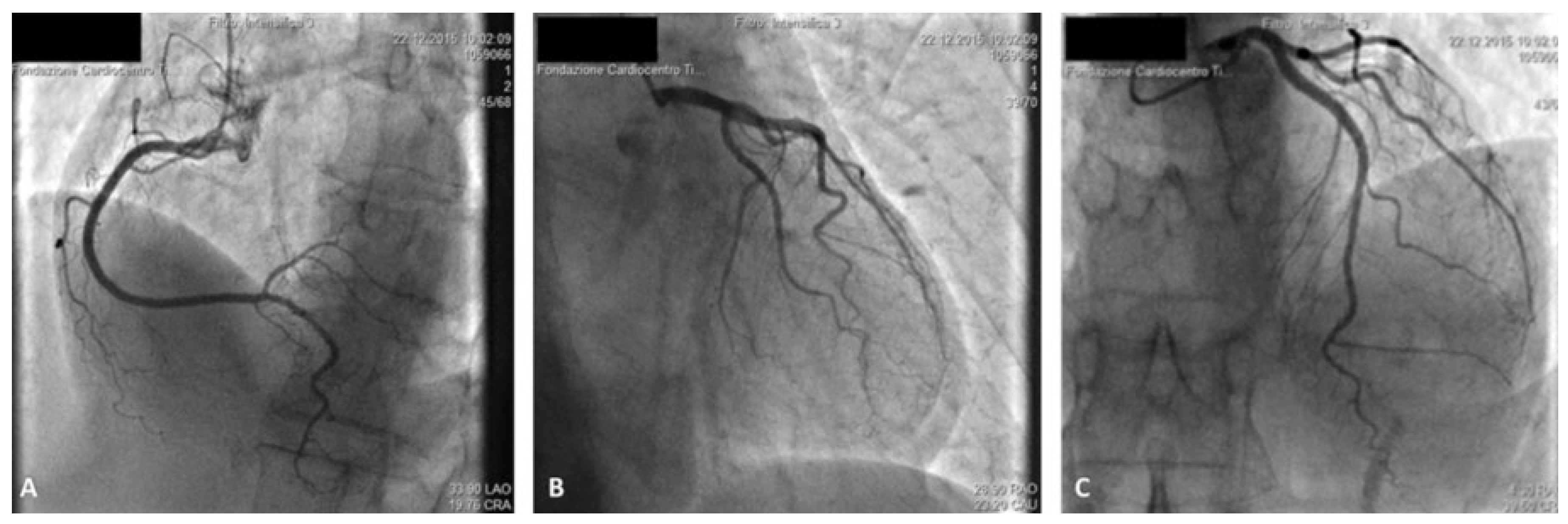 Cardiovascmed 20 00105 g002