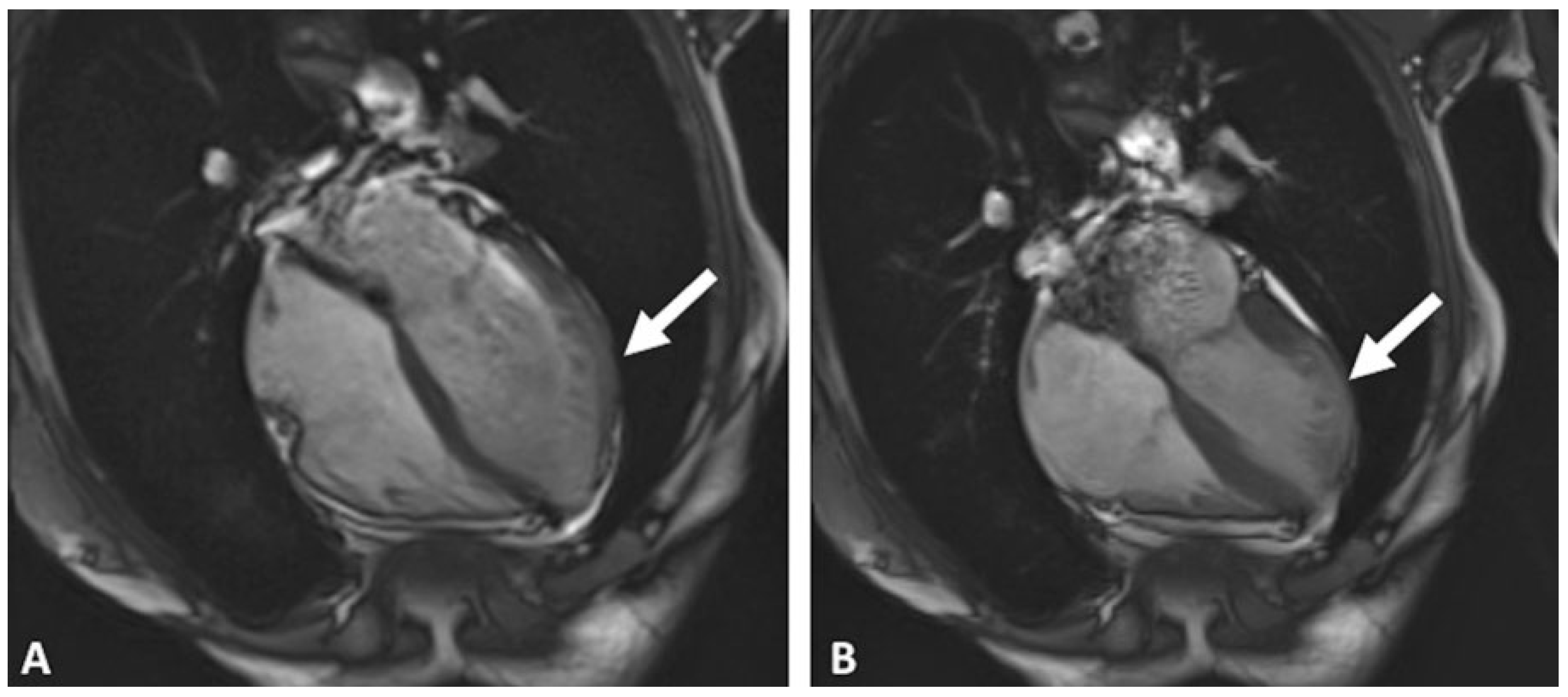 Cardiovascmed 20 00105 g003