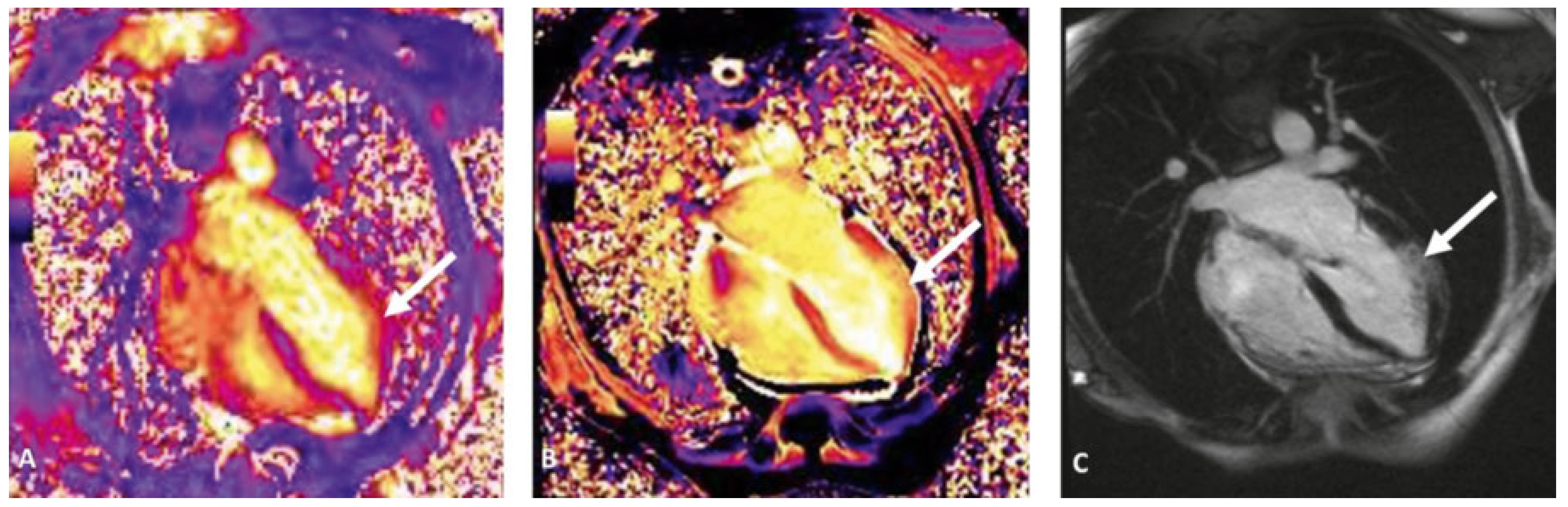 Cardiovascmed 20 00105 g004