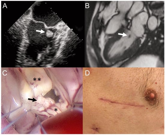 Cardiovascmed 20 00186 g001
