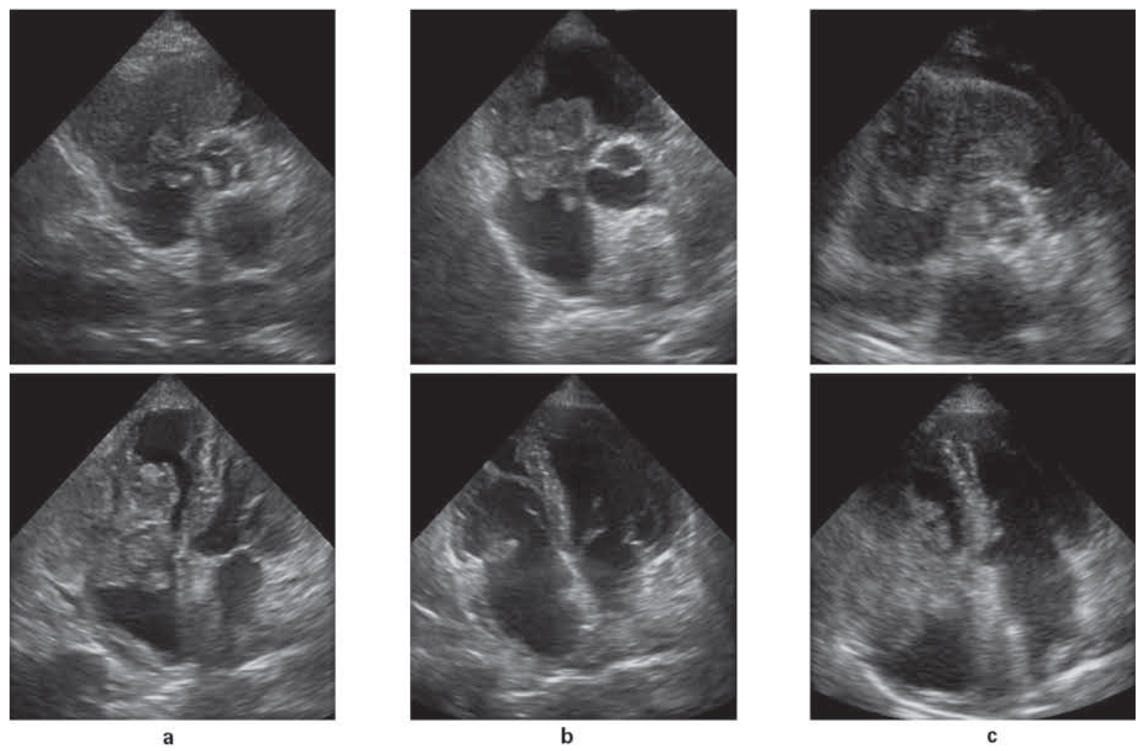 Cardiovascmed 20 00466 g001 Cardiovascmed 20 00466 g001