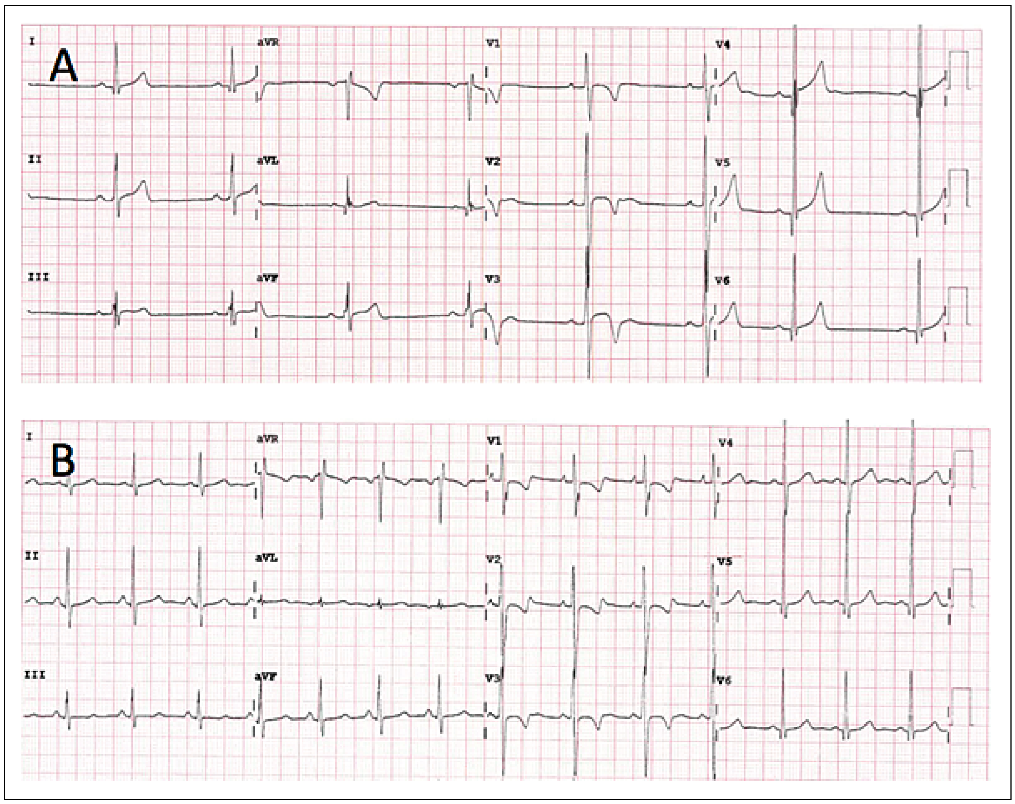 Cardiovascmed 21 00007 g001