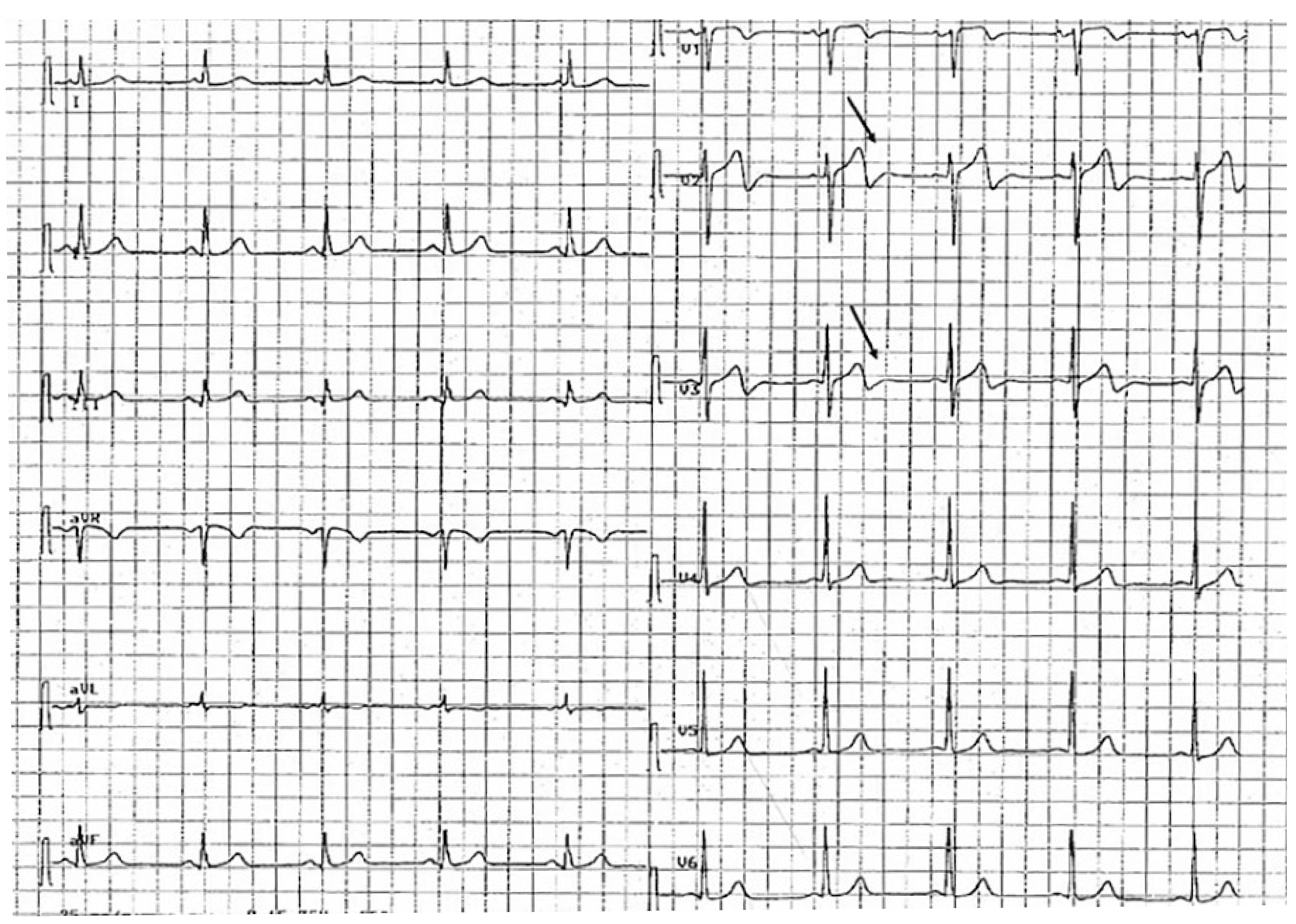 Cardiovascmed 21 00022 g001
