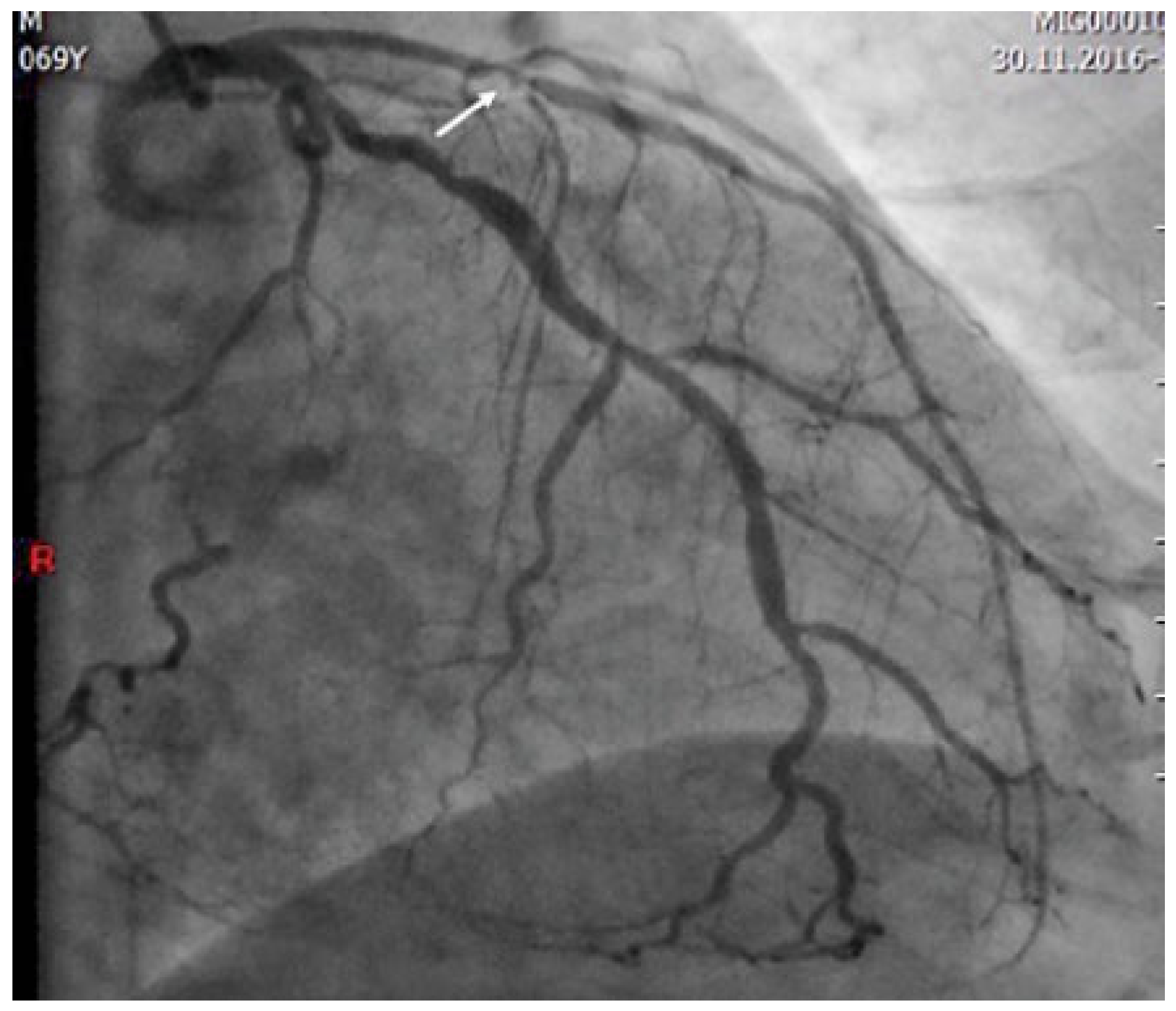 Cardiovascmed 21 00022 g002