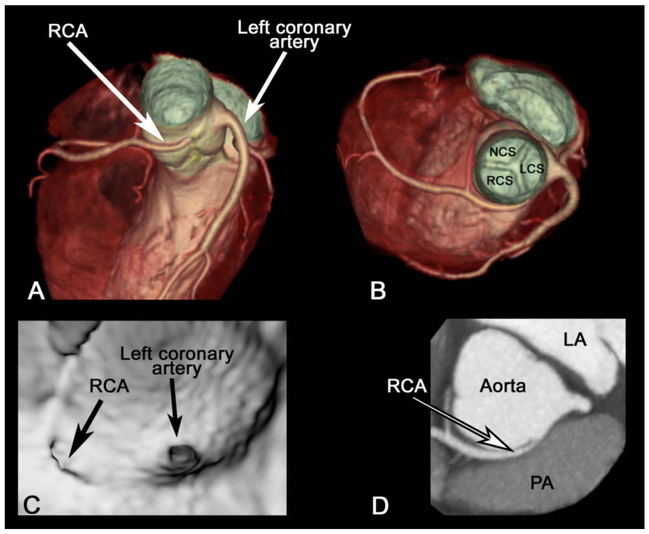 Cardiovascmed 21 00039 g002