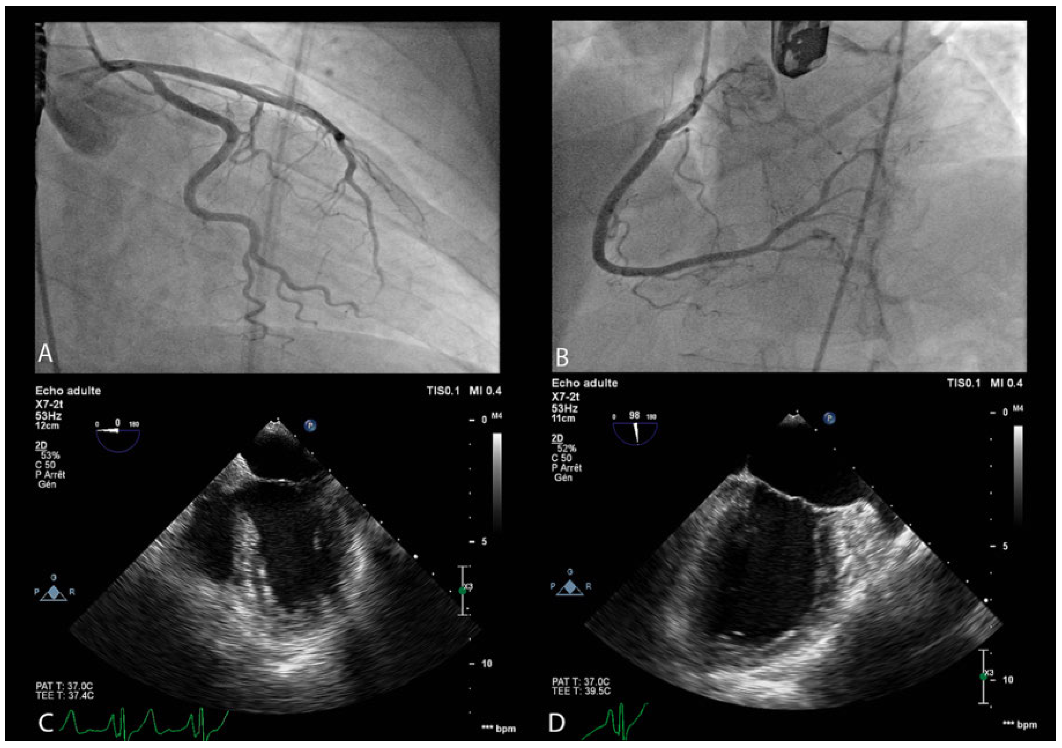 Cardiovascmed 21 00075 g001 Cardiovascmed 21 00075 g001