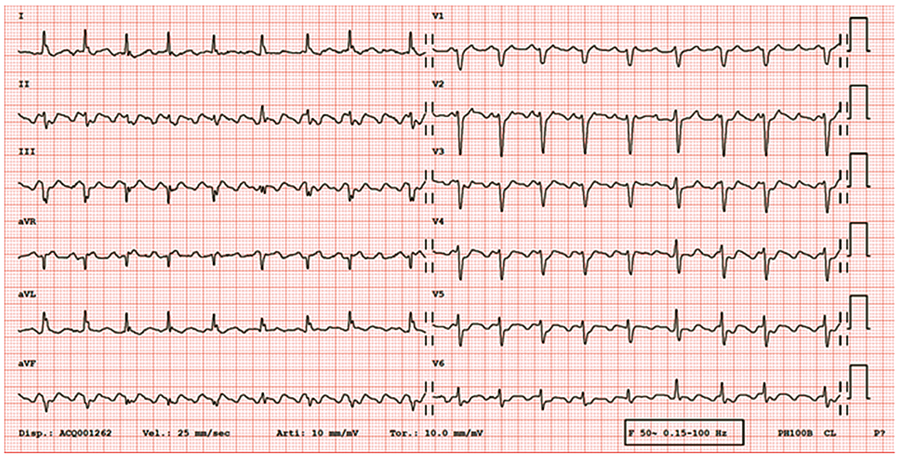 Cardiovascmed 21 00078 g001