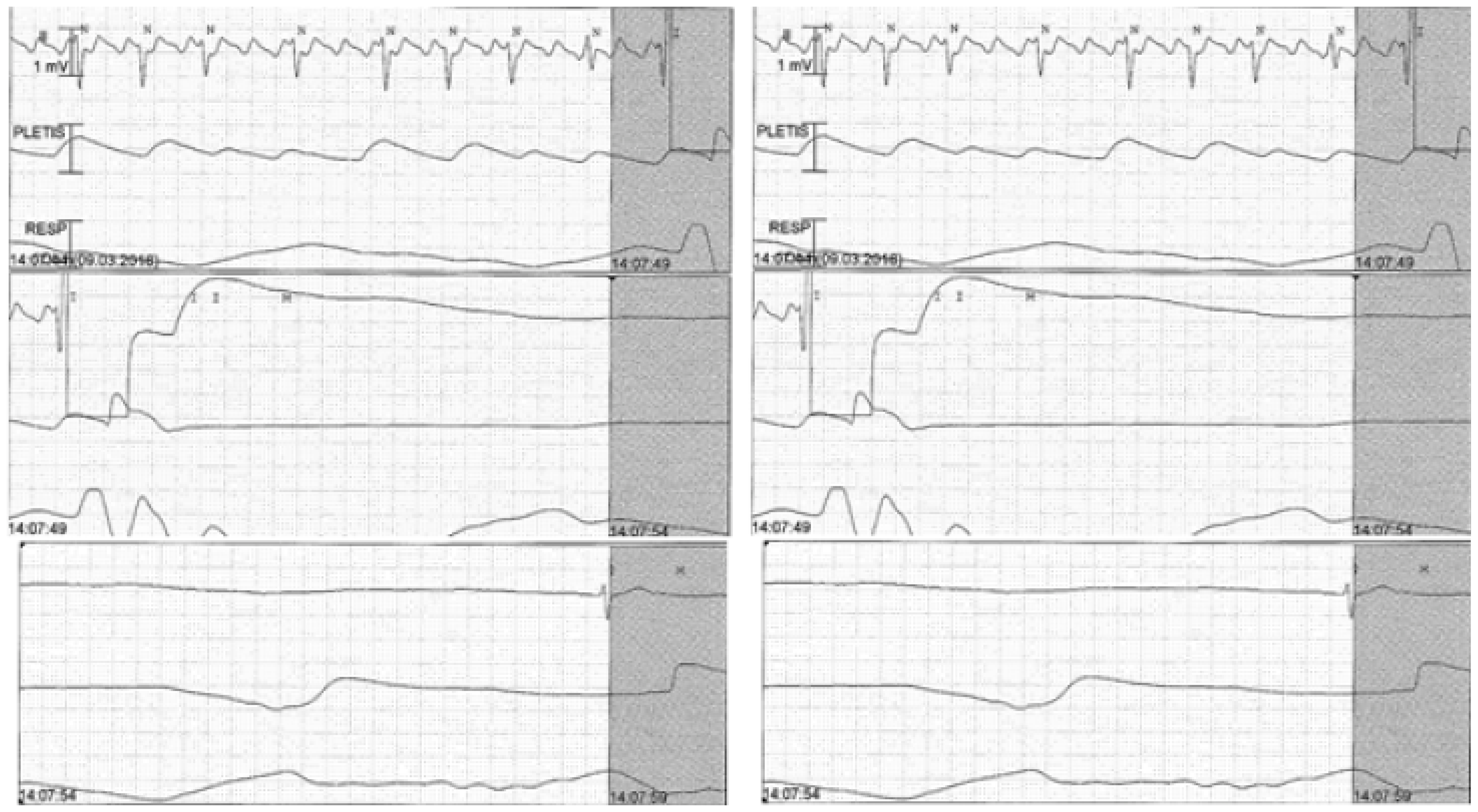Cardiovascmed 21 00078 g002