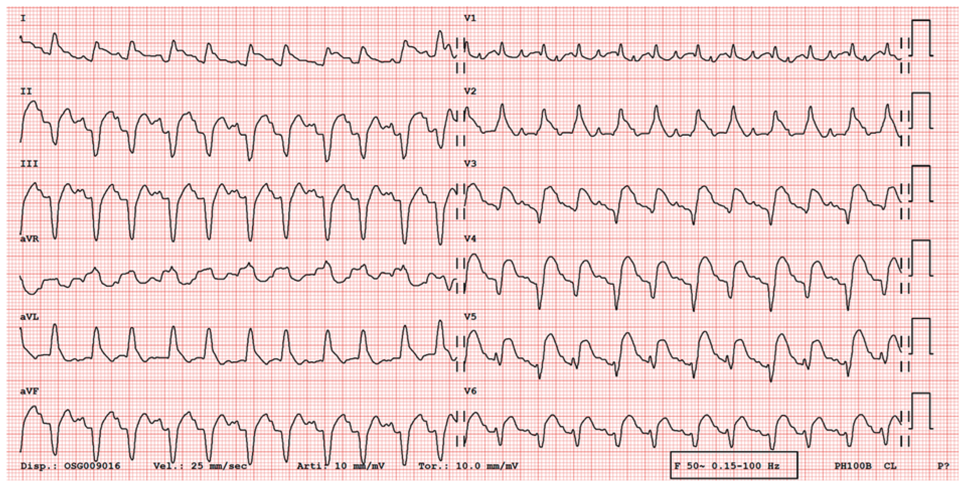 Cardiovascmed 21 00078 g003
