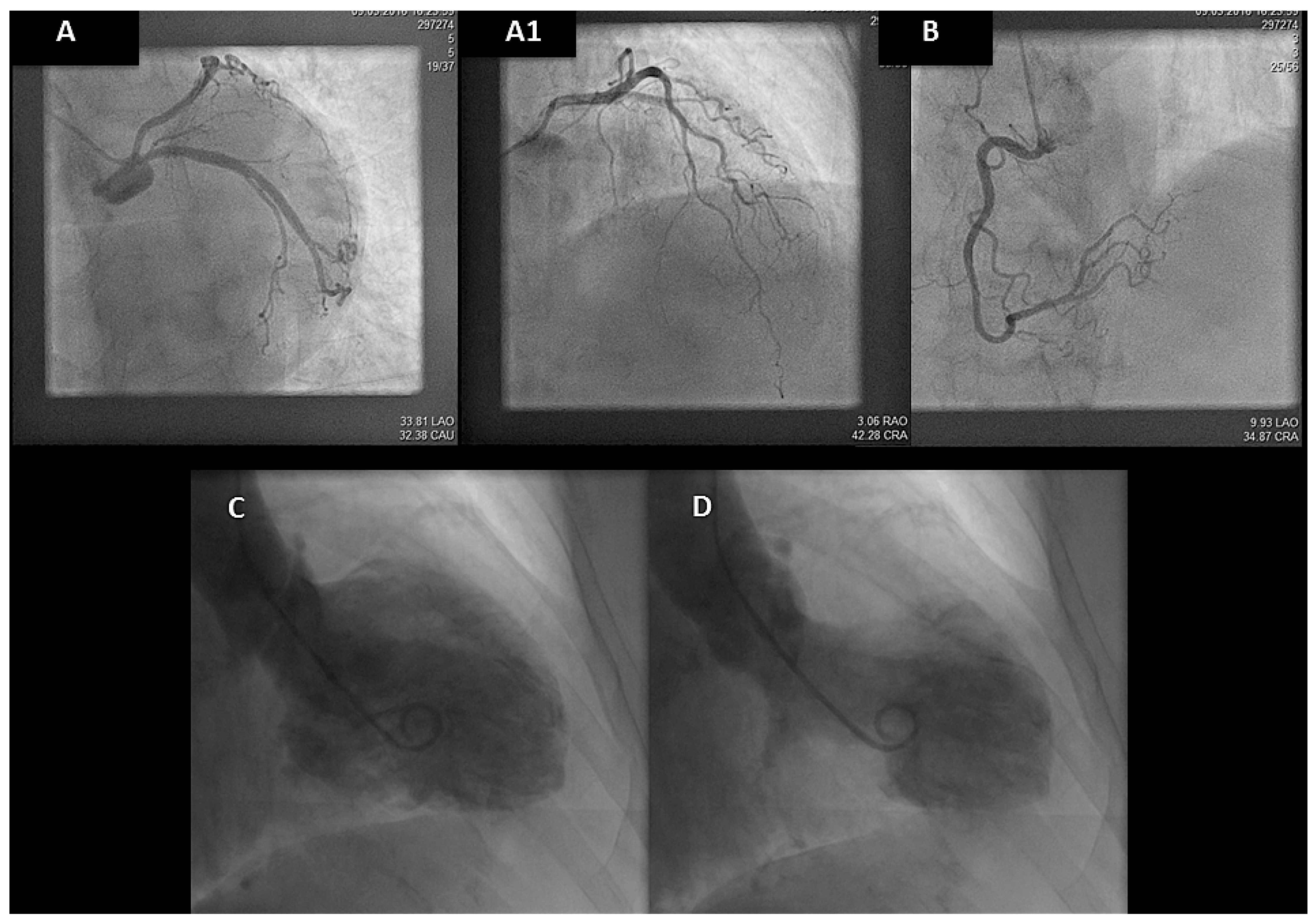 Cardiovascmed 21 00078 g004