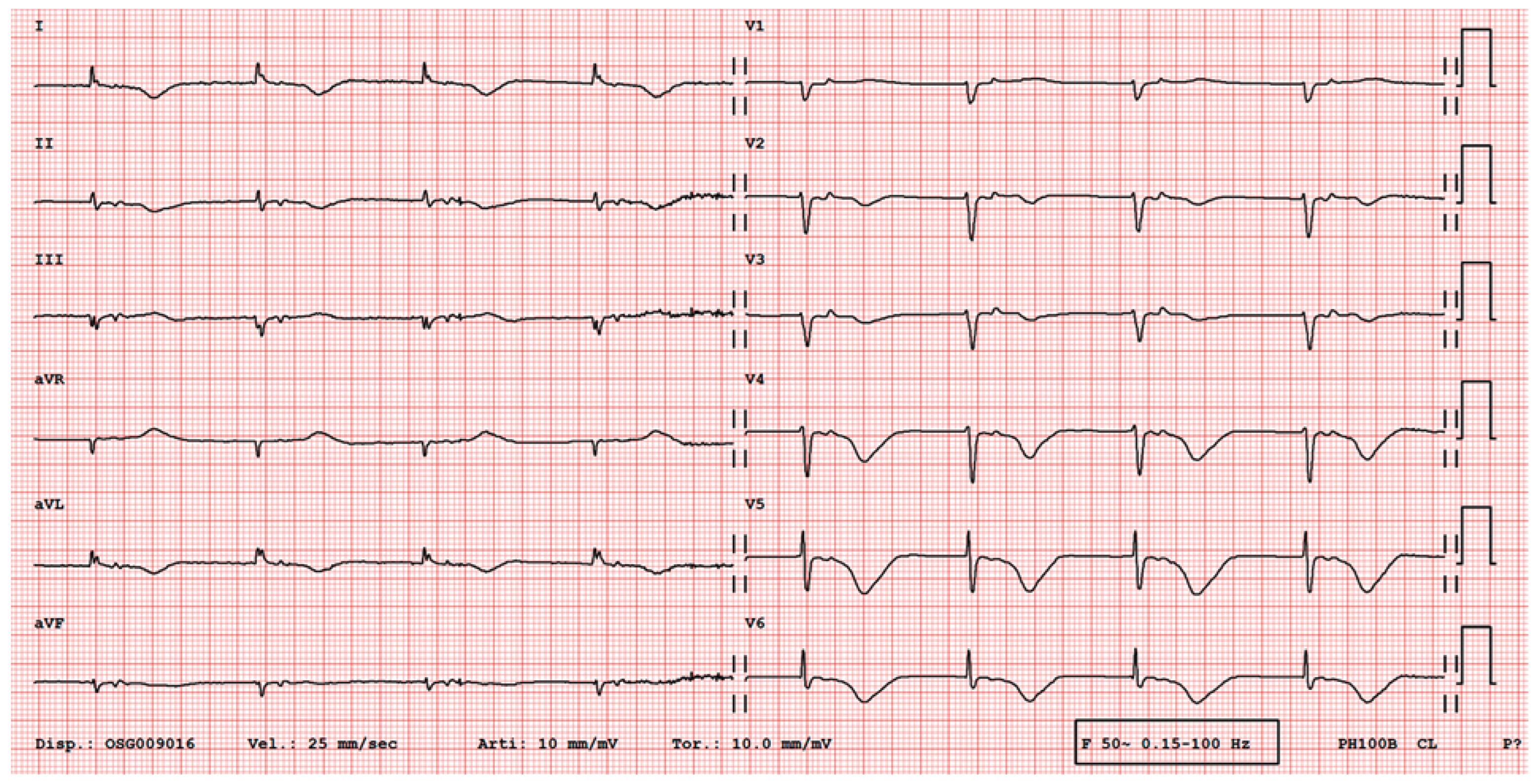 Cardiovascmed 21 00078 g005