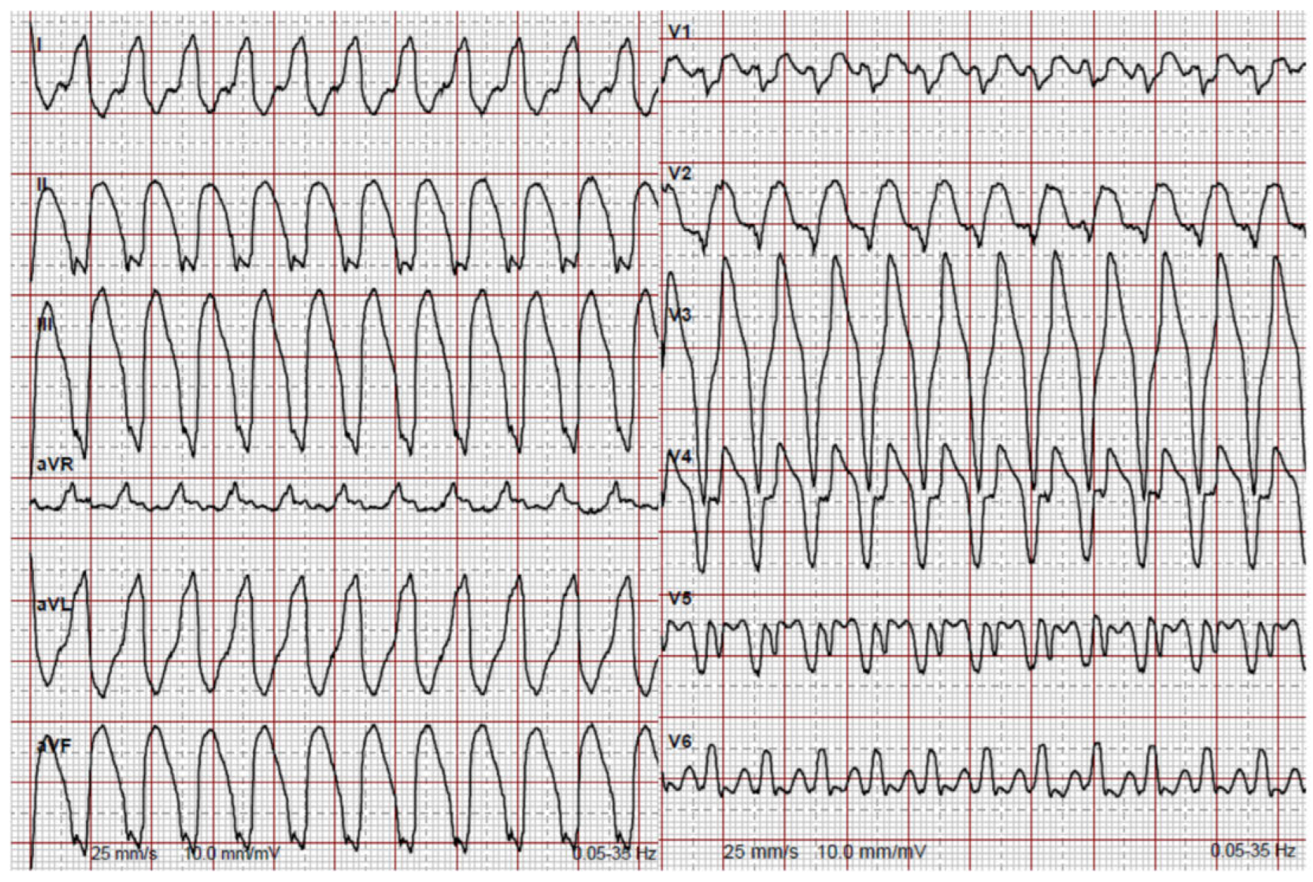Cardiovascmed 21 00090 g002