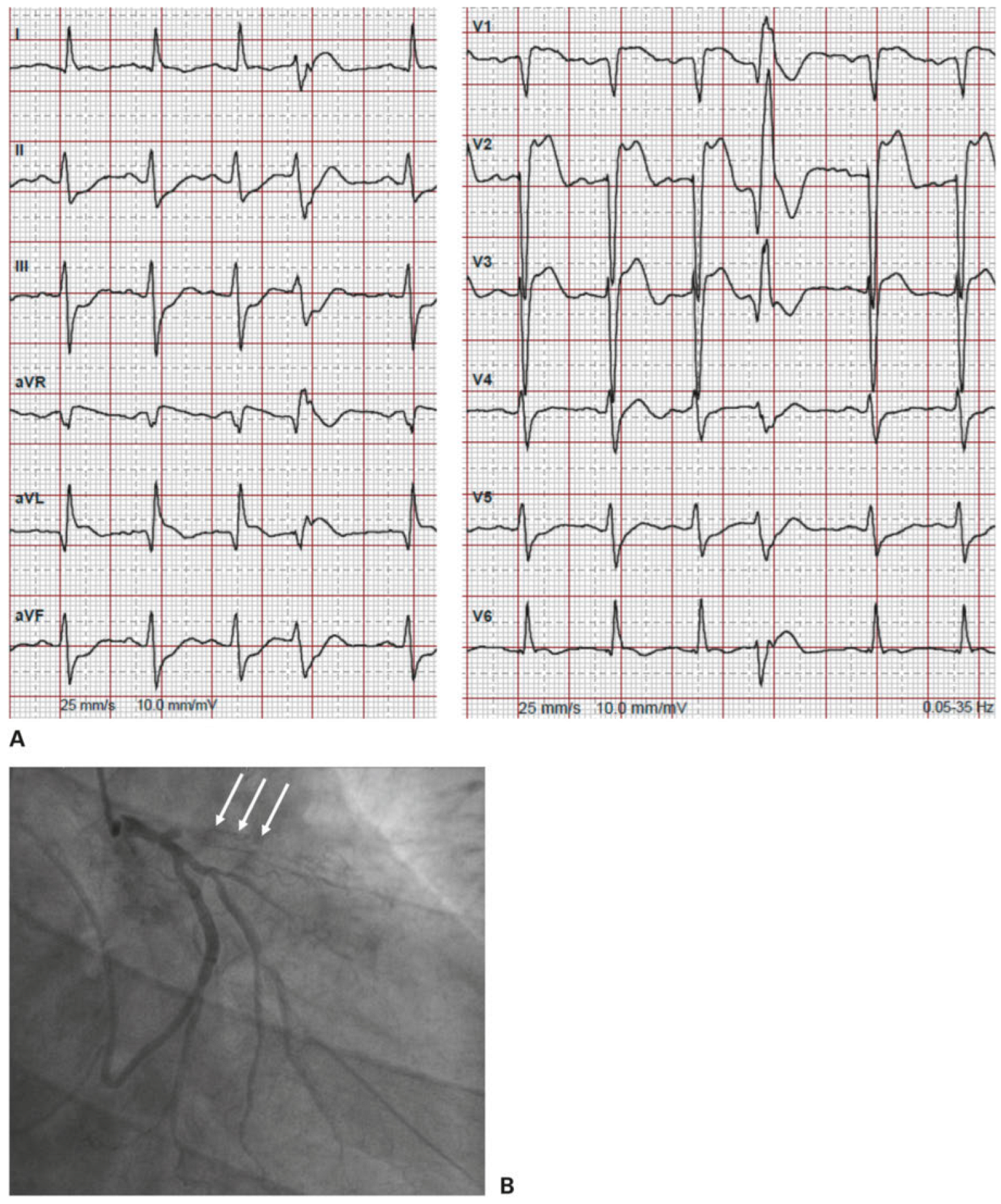 Cardiovascmed 21 00090 g005