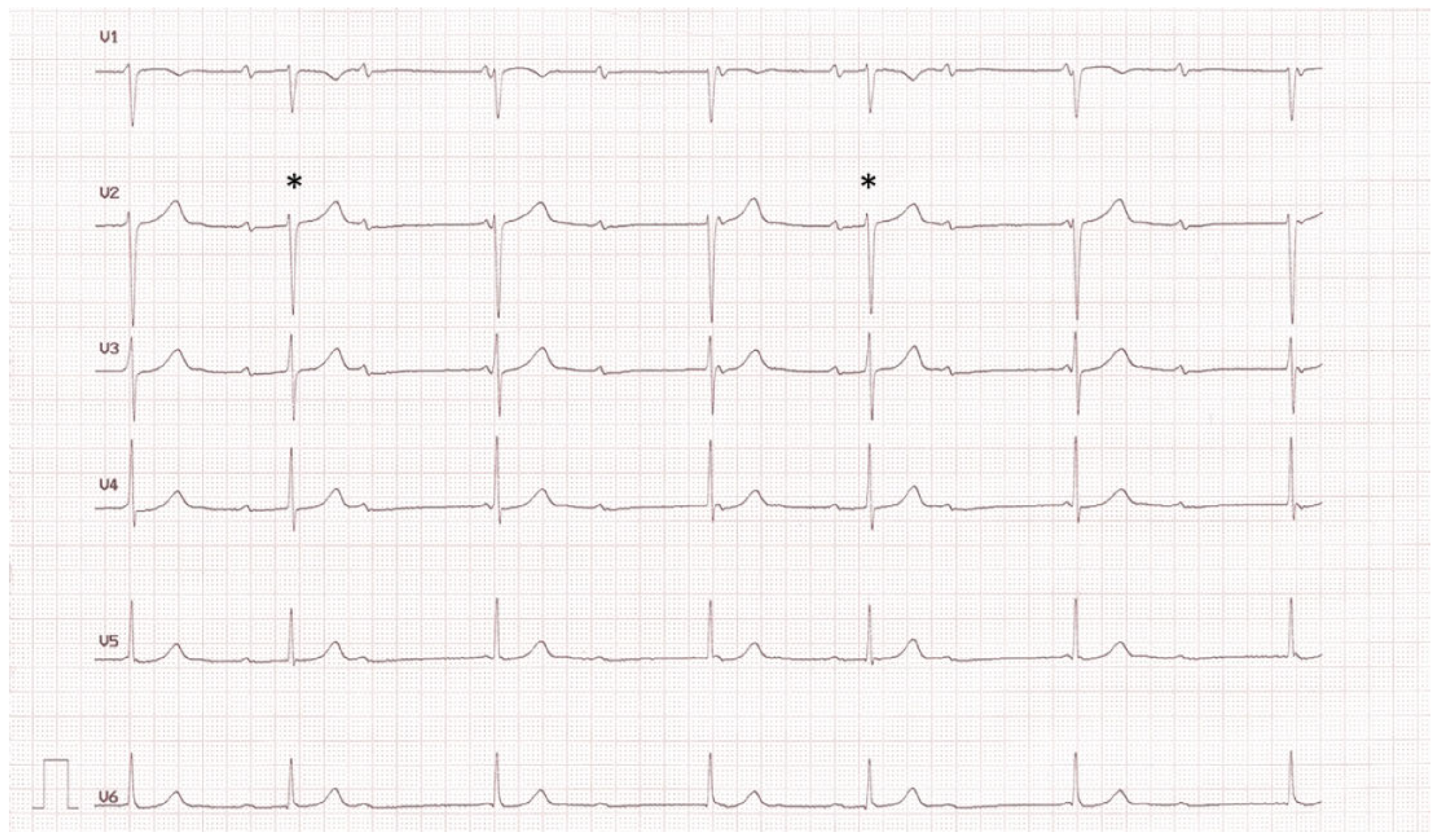 Cardiovascmed 21 00098 g001