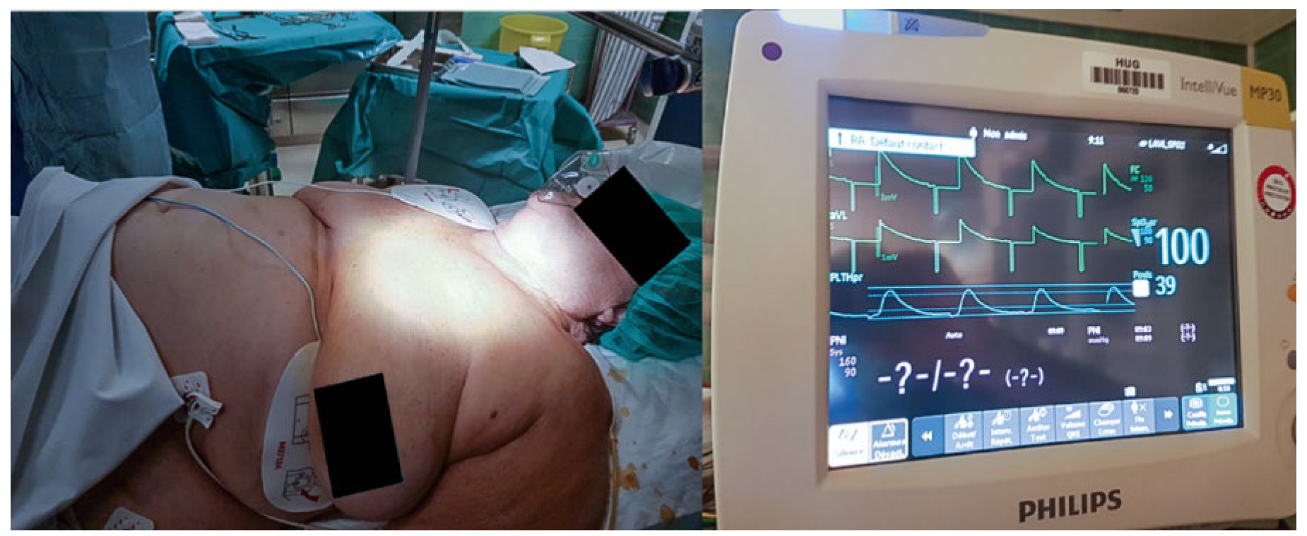 Cardiovascmed 21 00098 g004