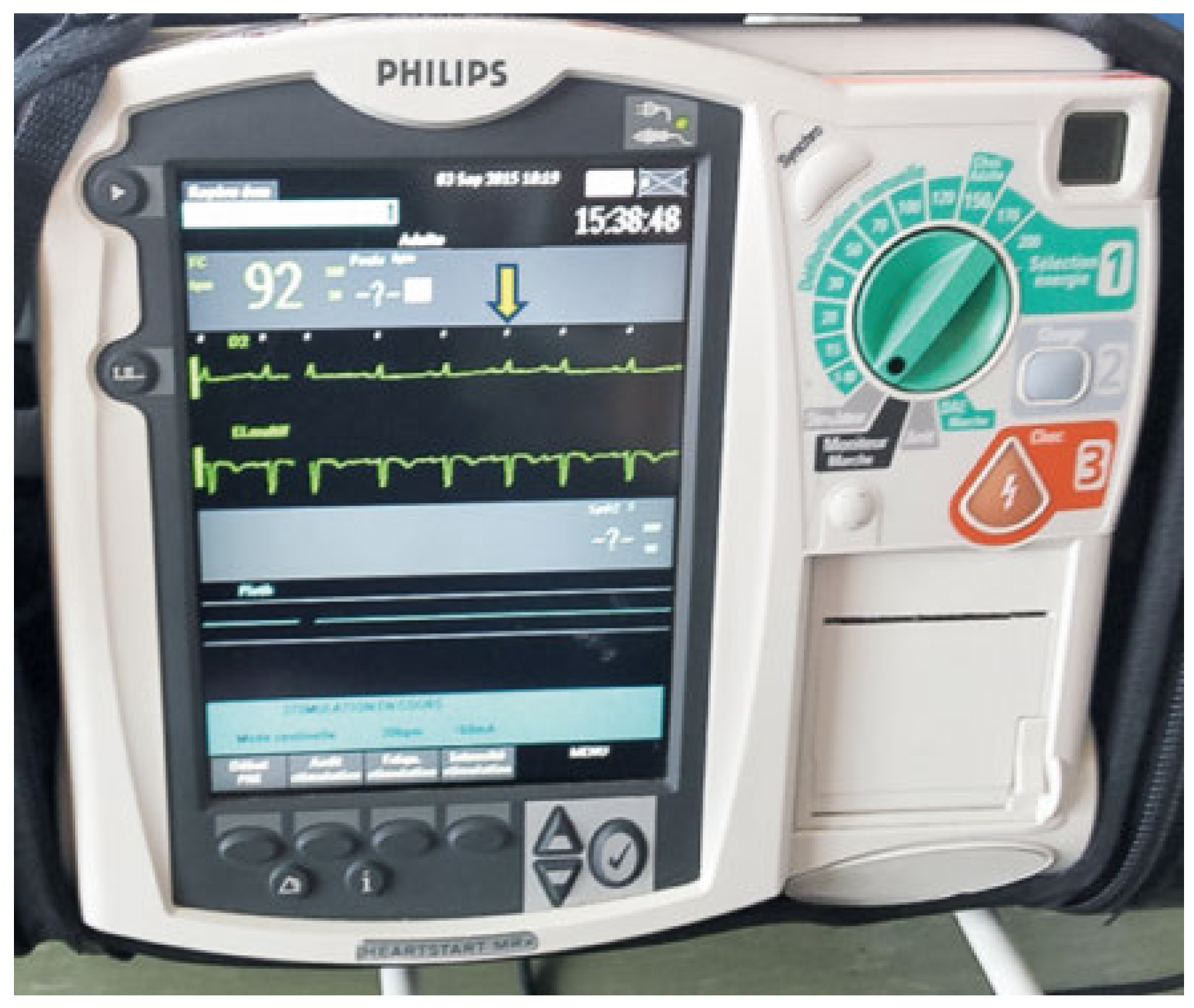 Cardiovascmed 21 00098 g006