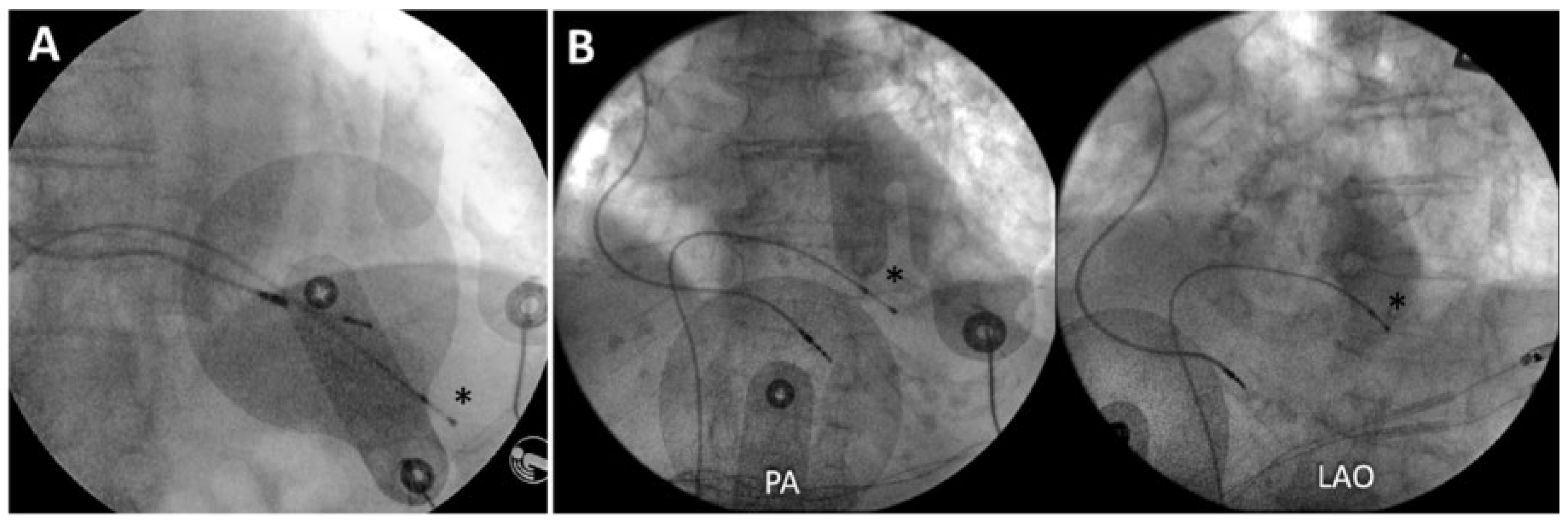Cardiovascmed 21 00098 g007