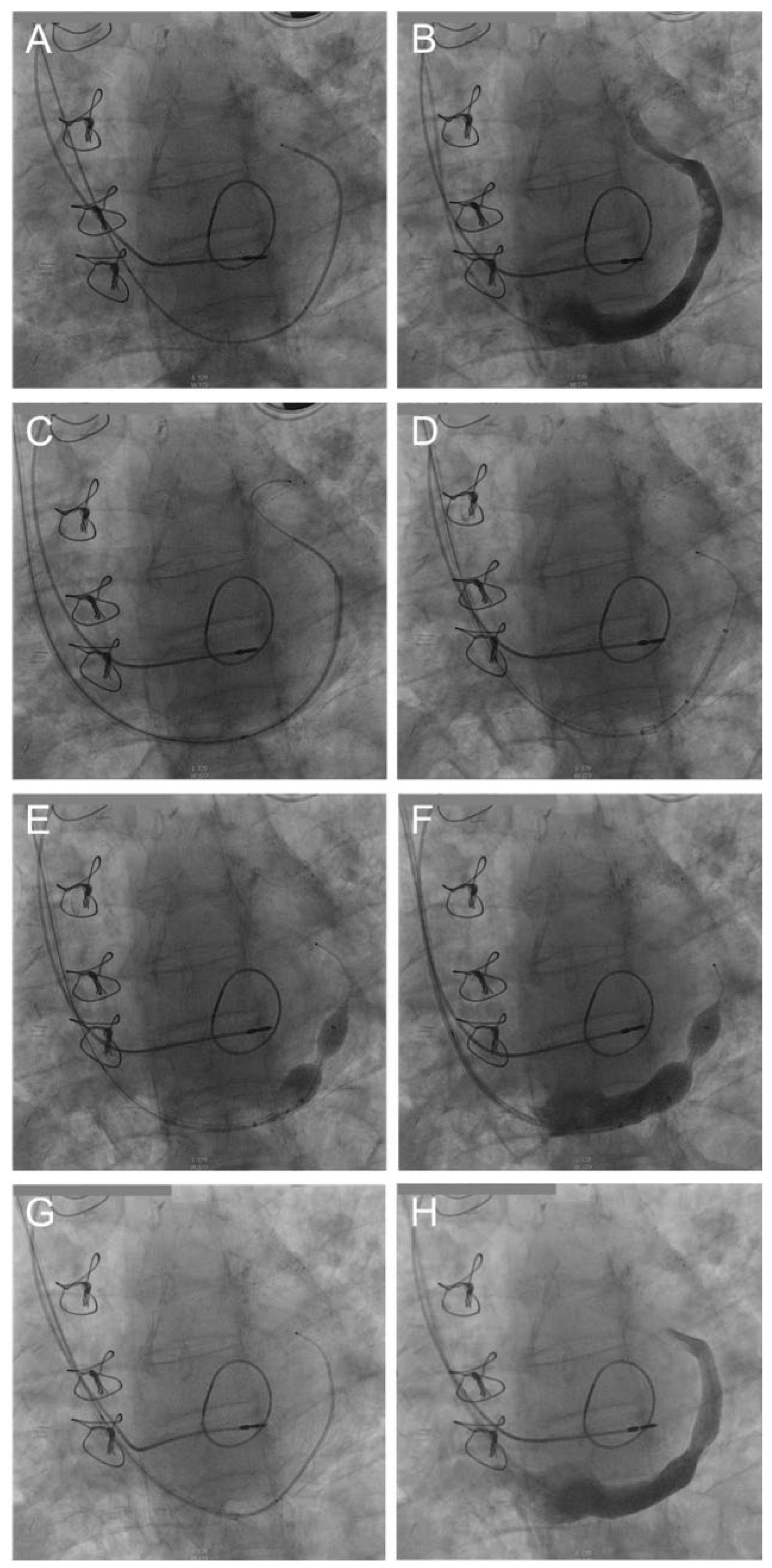 Cardiovascmed 21 00105 g002