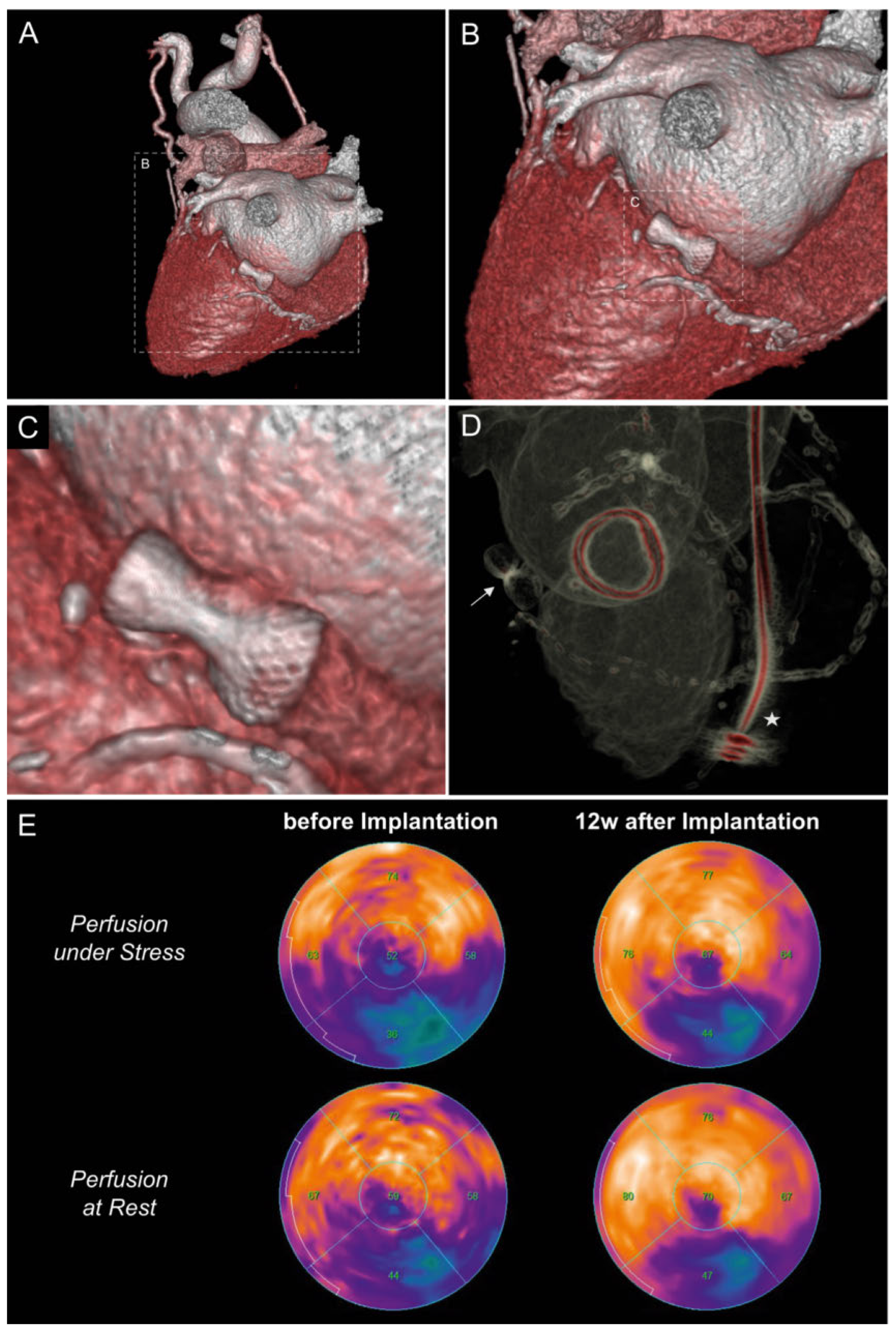 Cardiovascmed 21 00105 g003
