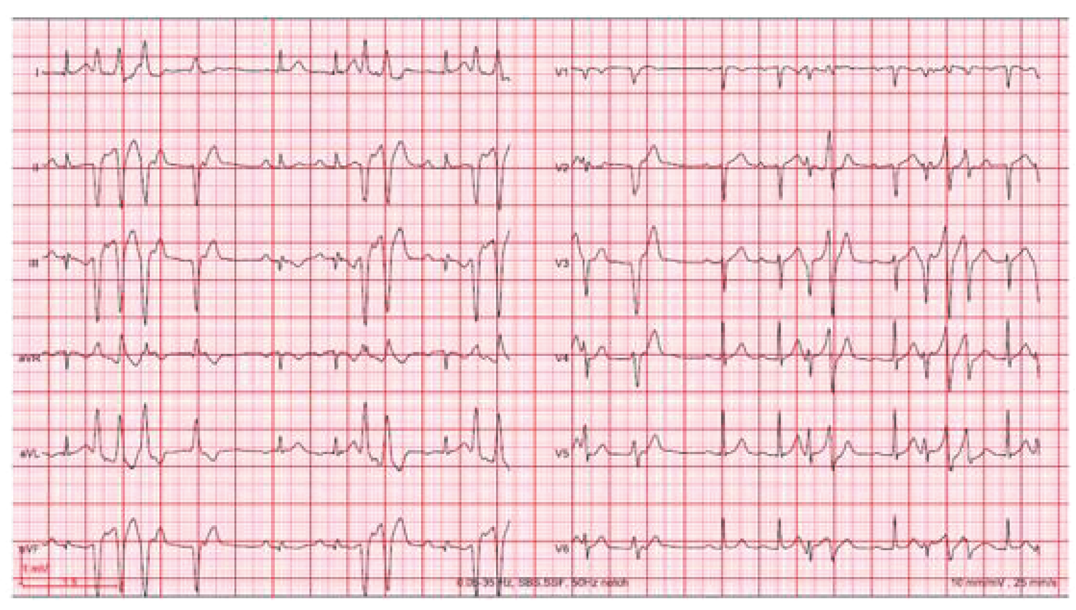 Cardiovascmed 21 00111 i007 Cardiovascmed 21 00111 i007