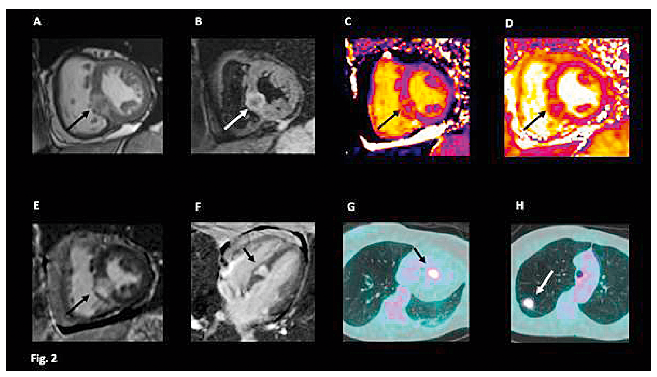 Cardiovascmed 21 00111 i008 Cardiovascmed 21 00111 i008