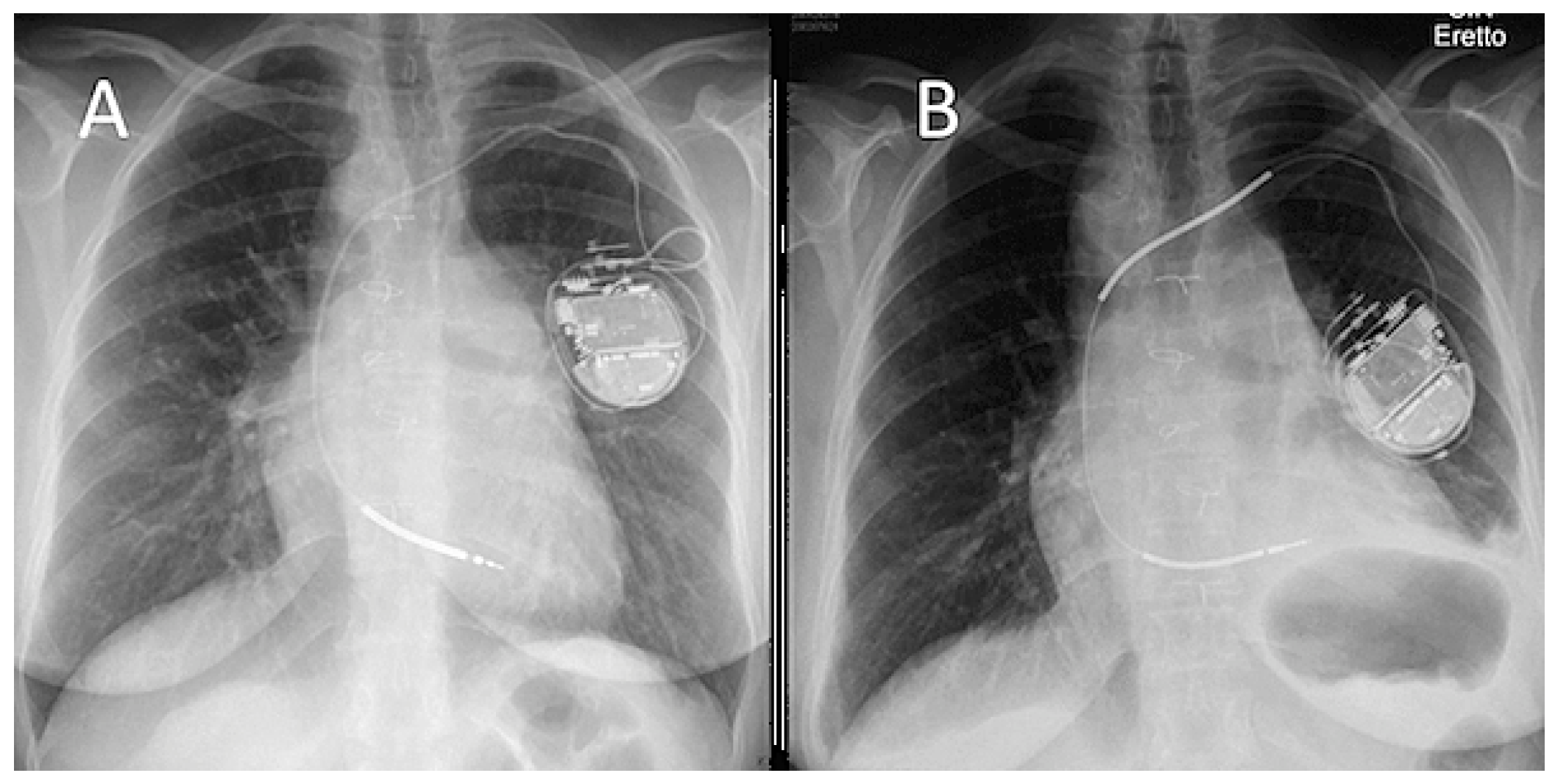 Cardiovascmed 21 00111 i010 Cardiovascmed 21 00111 i010