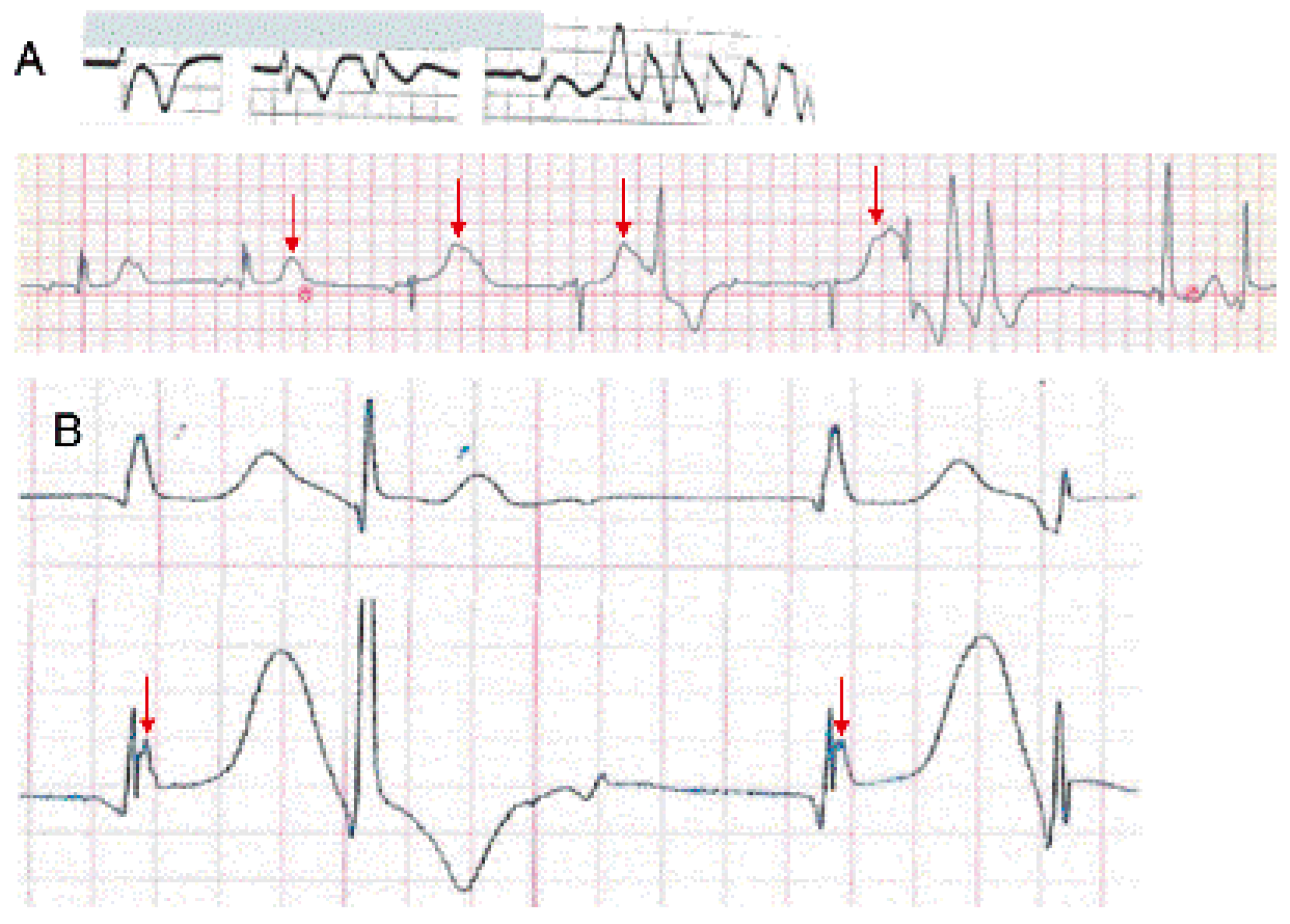 Cardiovascmed 21 00111 i012 Cardiovascmed 21 00111 i012