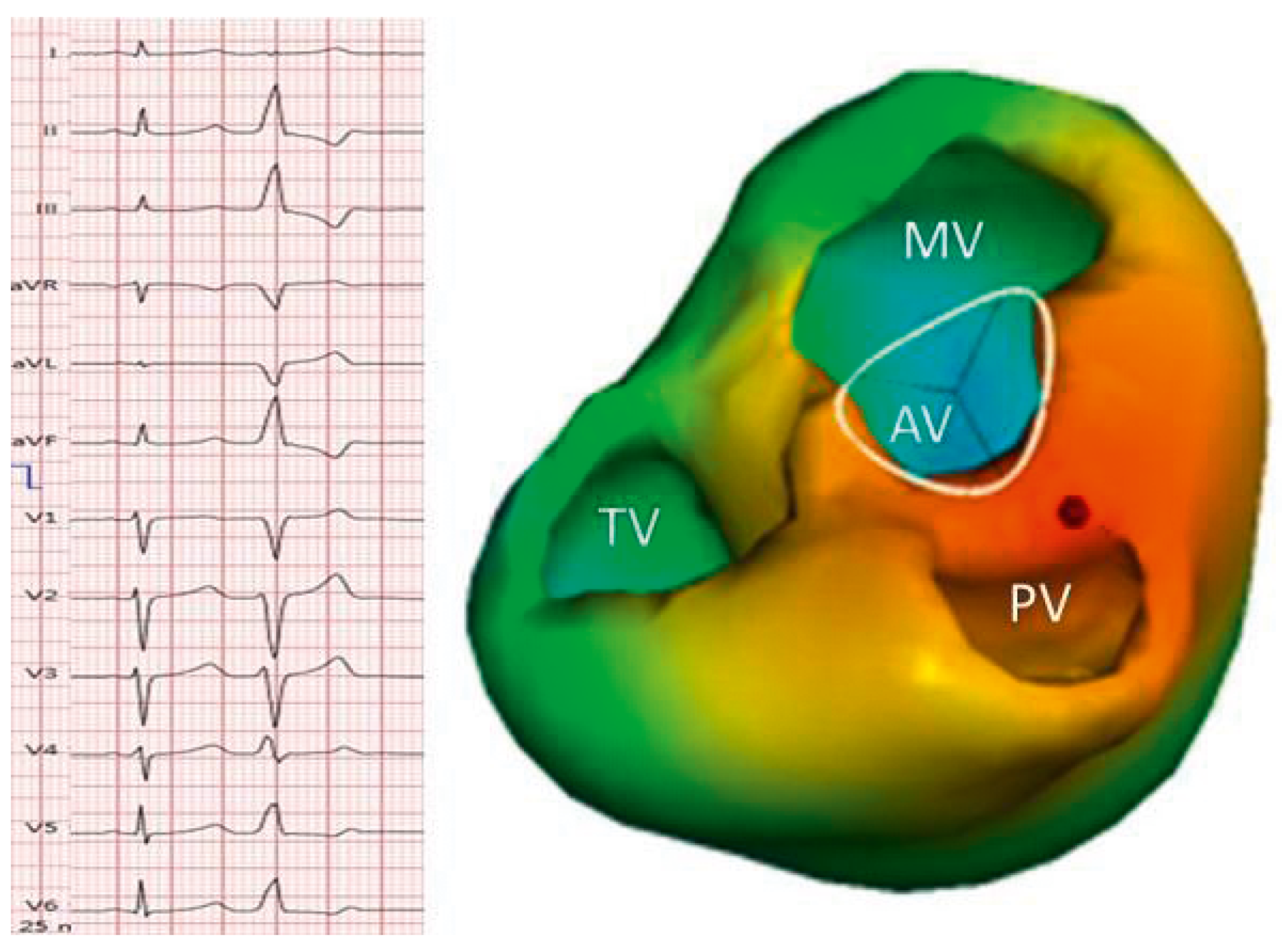 Cardiovascmed 21 00111 i016 Cardiovascmed 21 00111 i016