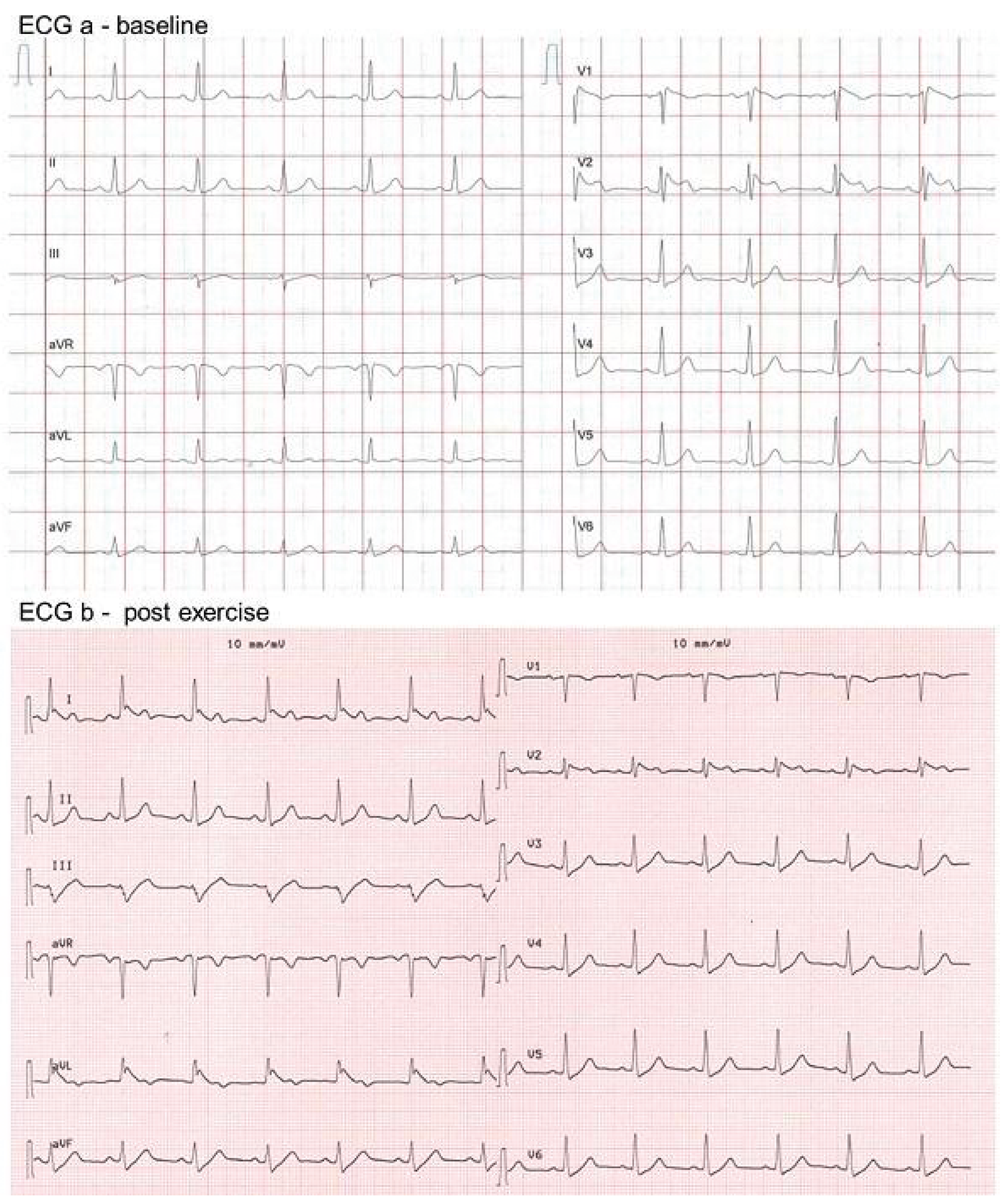 Cardiovascmed 21 00111 i027 Cardiovascmed 21 00111 i027