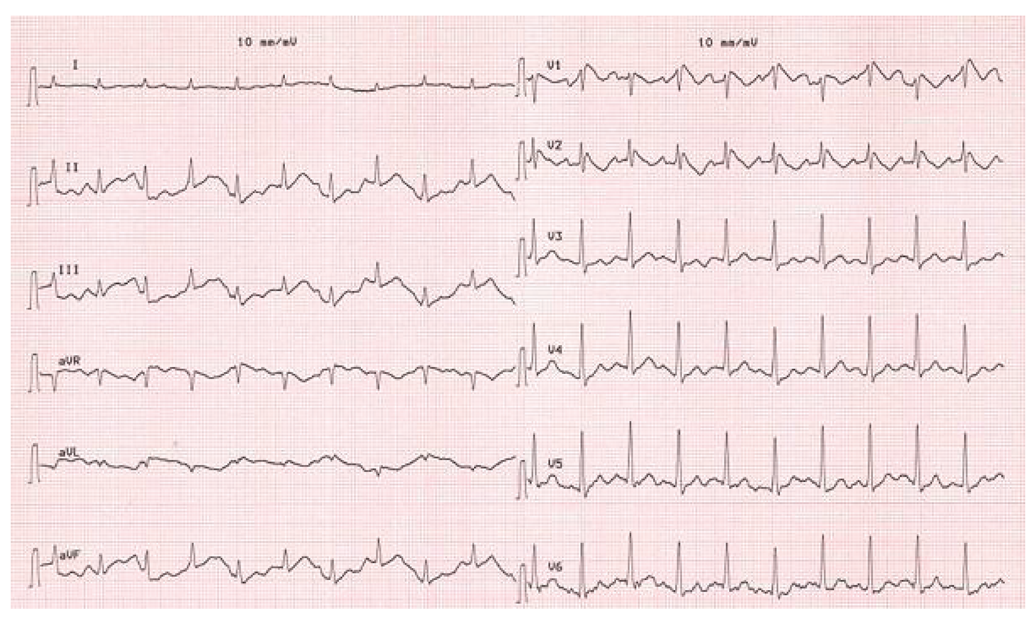 Cardiovascmed 21 00111 i028 Cardiovascmed 21 00111 i028