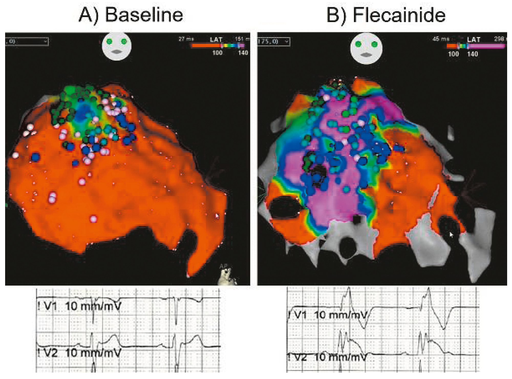 Cardiovascmed 21 00111 i029 Cardiovascmed 21 00111 i029