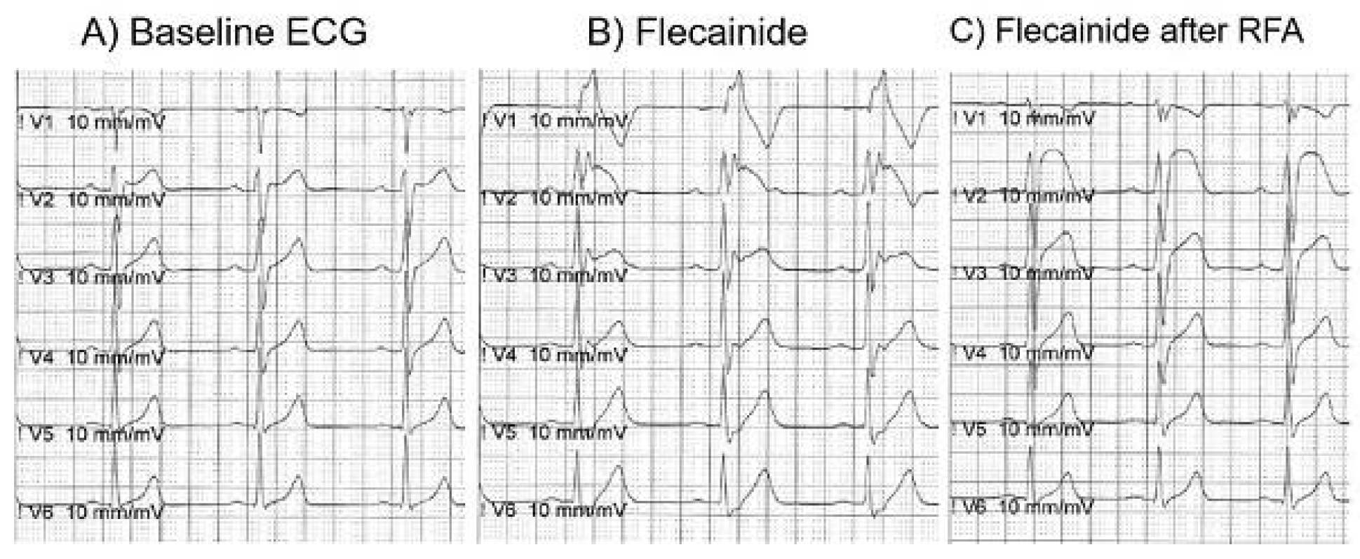 Cardiovascmed 21 00111 i030 Cardiovascmed 21 00111 i030
