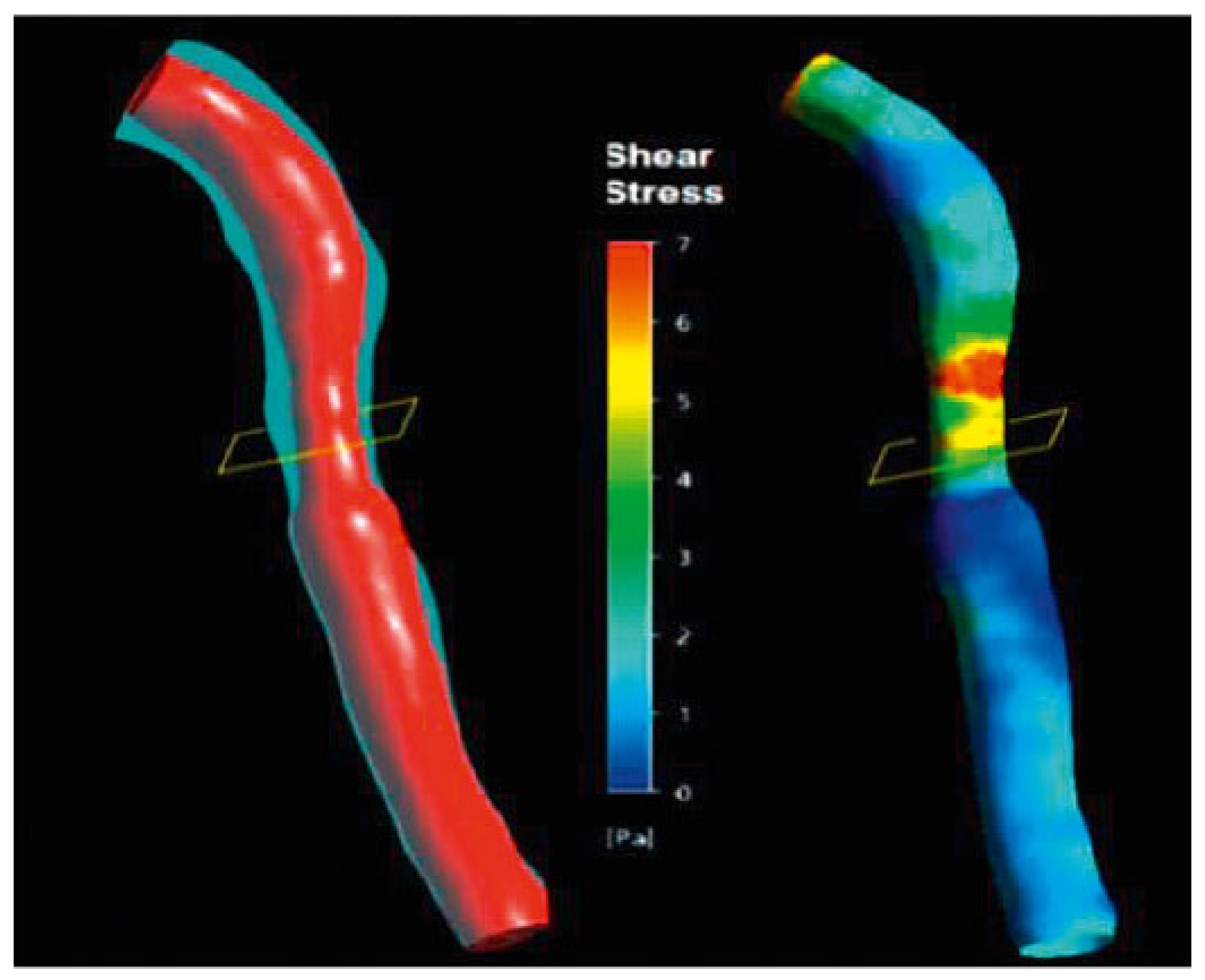 Cardiovascmed 21 00111 i031 Cardiovascmed 21 00111 i031