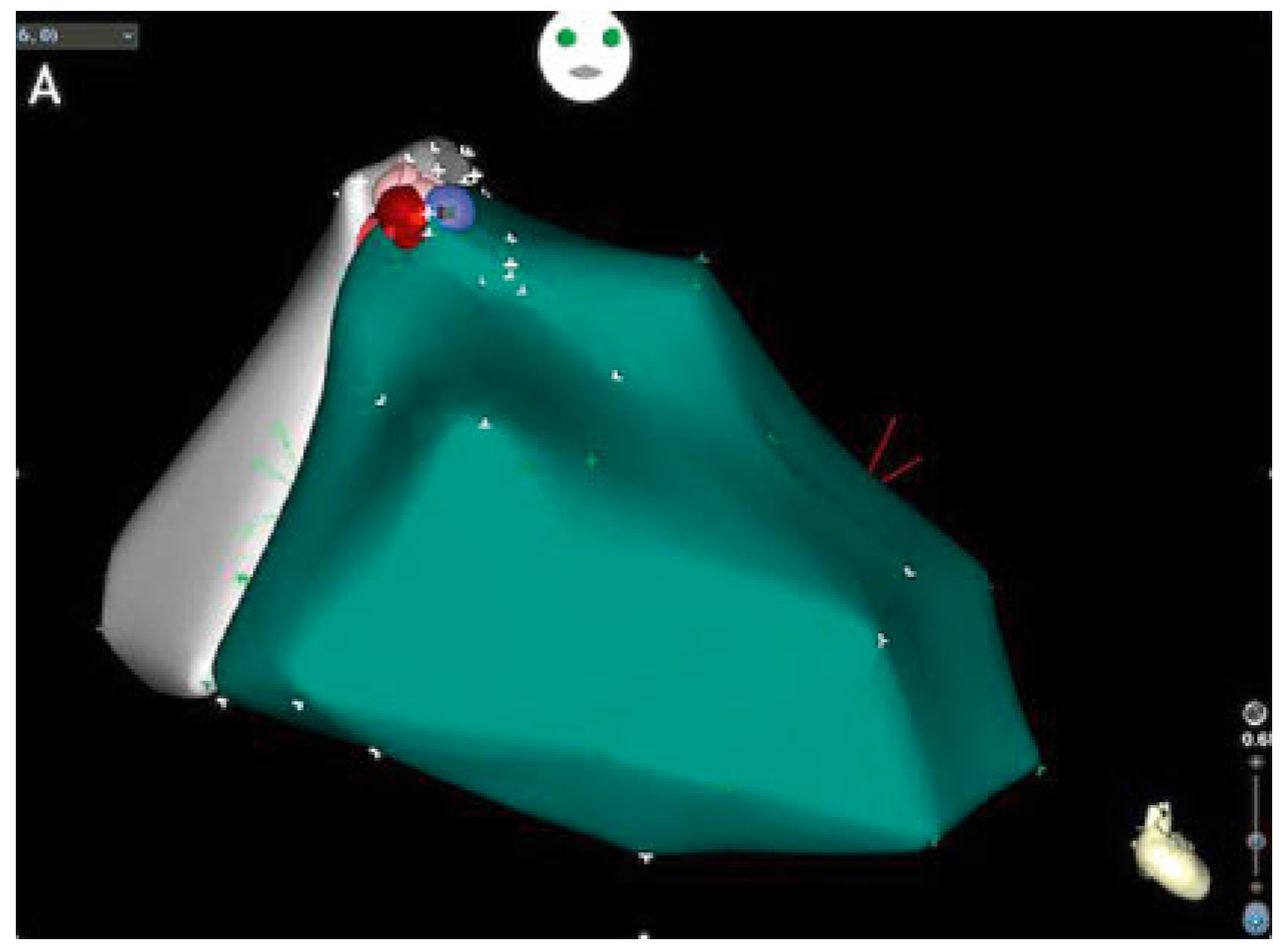 Cardiovascmed 21 00111 i044 Cardiovascmed 21 00111 i044