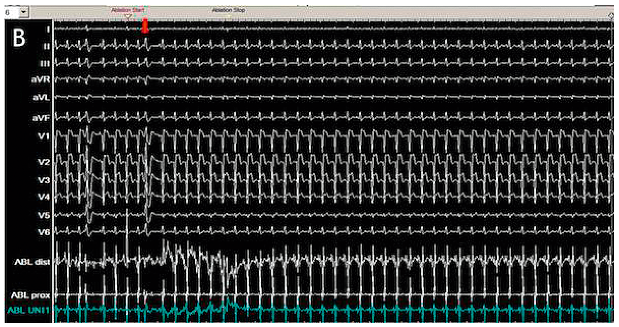 Cardiovascmed 21 00111 i045 Cardiovascmed 21 00111 i045