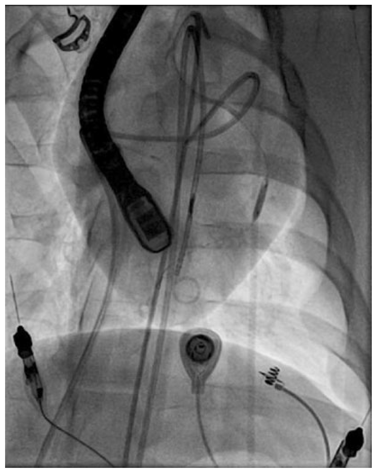 Cardiovascmed 21 00111 i051 Cardiovascmed 21 00111 i051