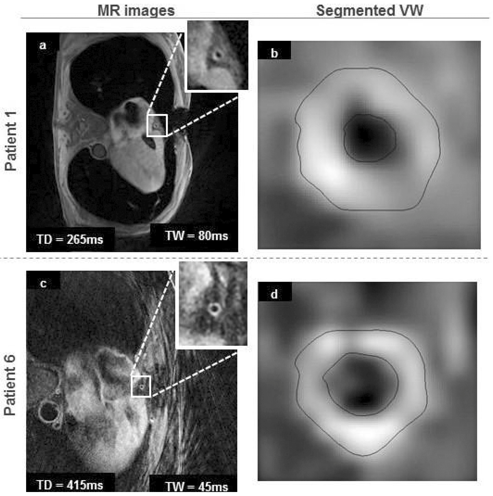 Cardiovascmed 21 00111 i057 Cardiovascmed 21 00111 i057
