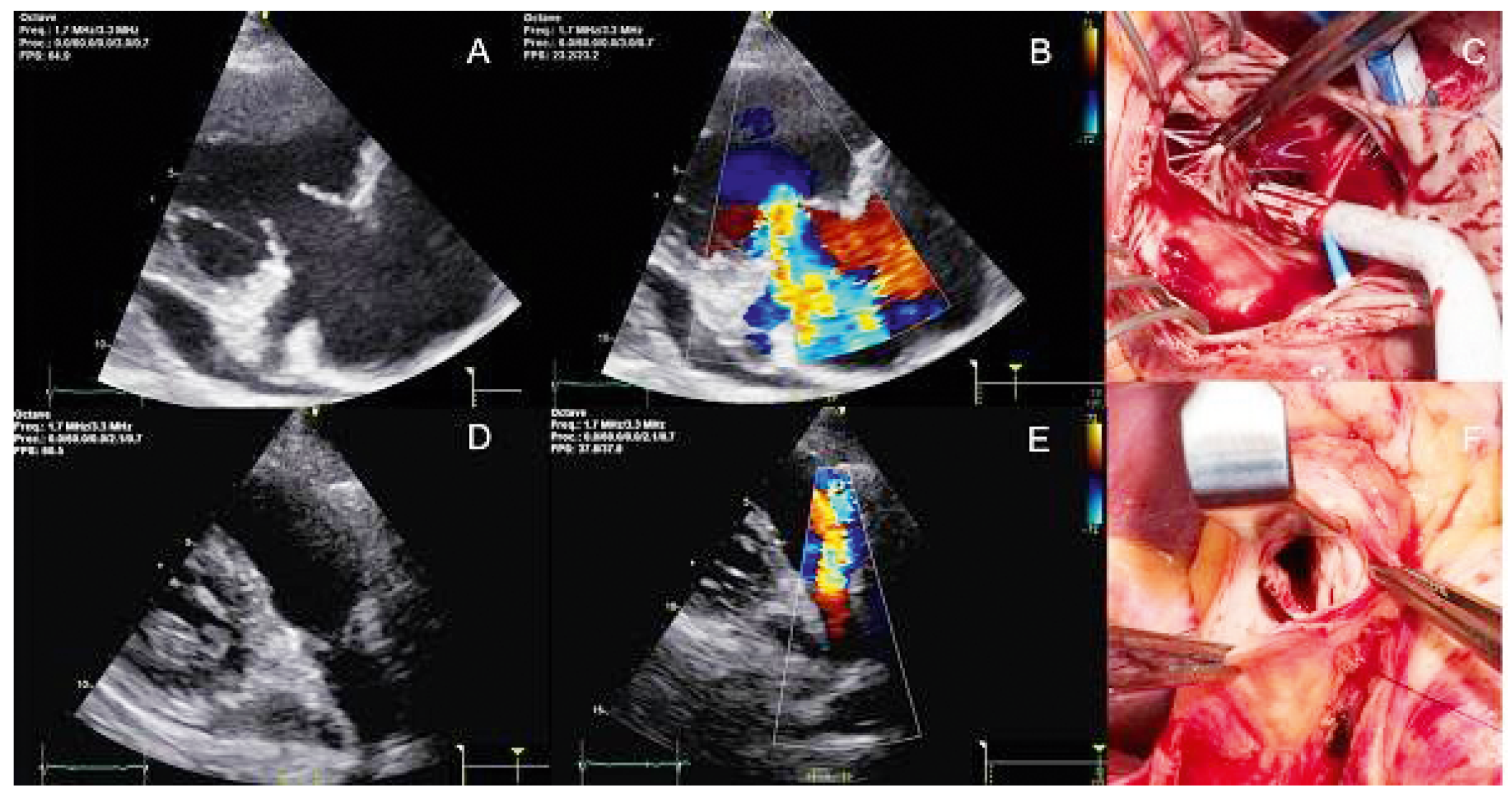 Cardiovascmed 21 00111 i058 Cardiovascmed 21 00111 i058