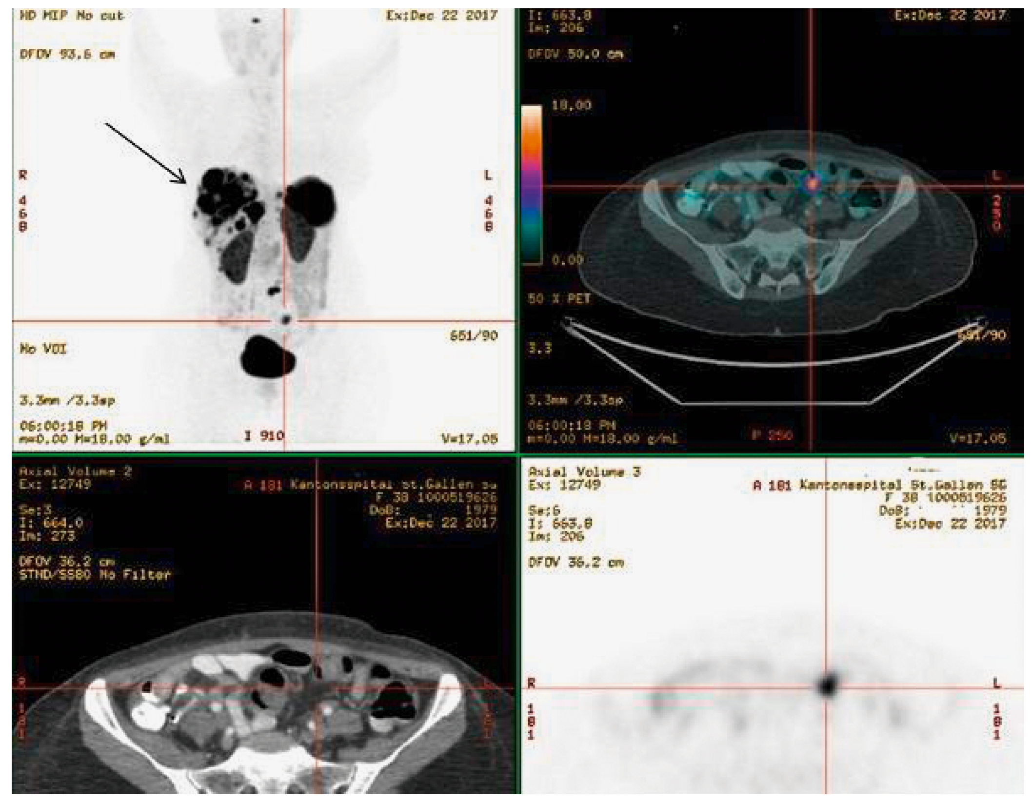 Cardiovascmed 21 00111 i059 Cardiovascmed 21 00111 i059