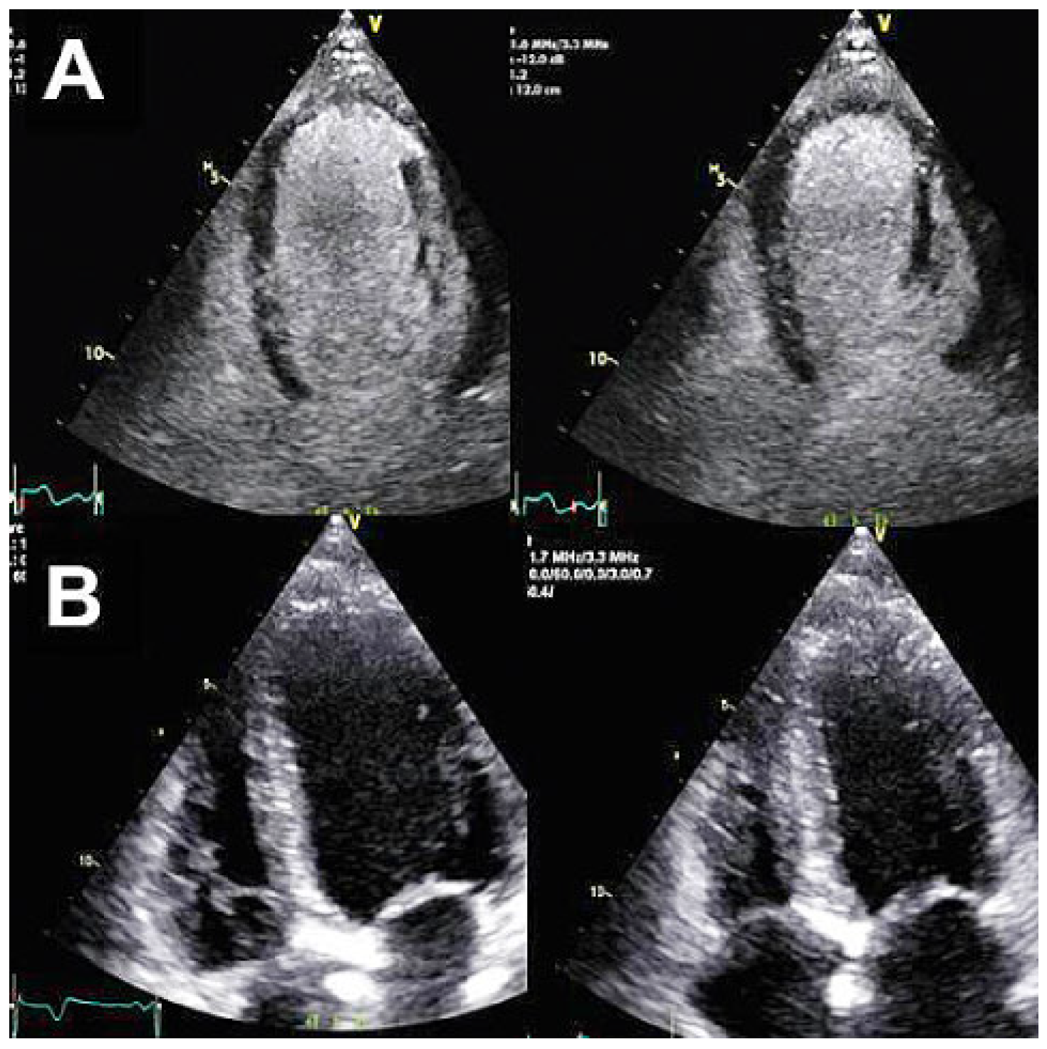 Cardiovascmed 21 00111 i060 Cardiovascmed 21 00111 i060