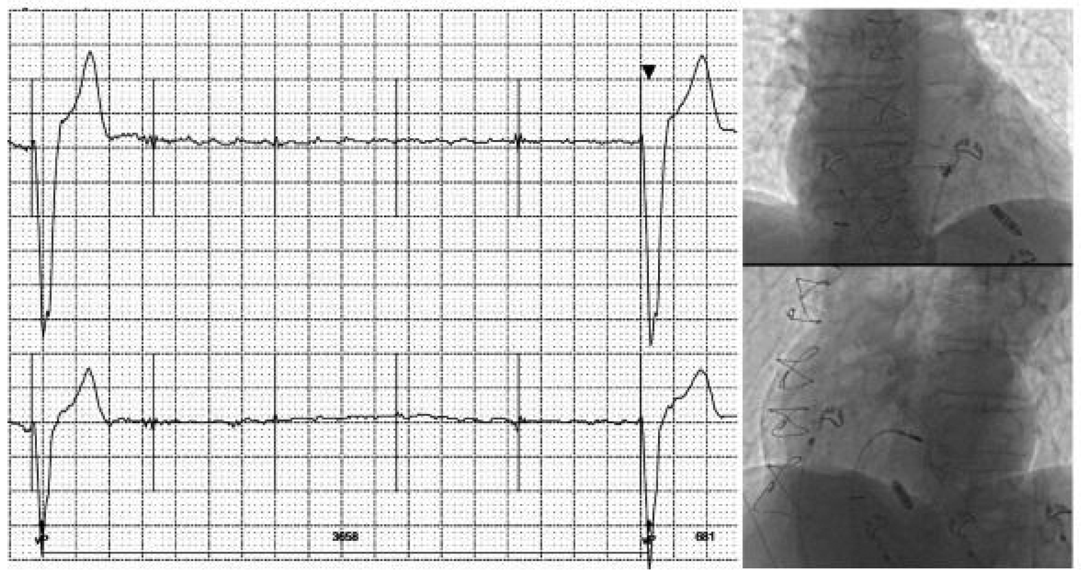 Cardiovascmed 21 00111 i065 Cardiovascmed 21 00111 i065