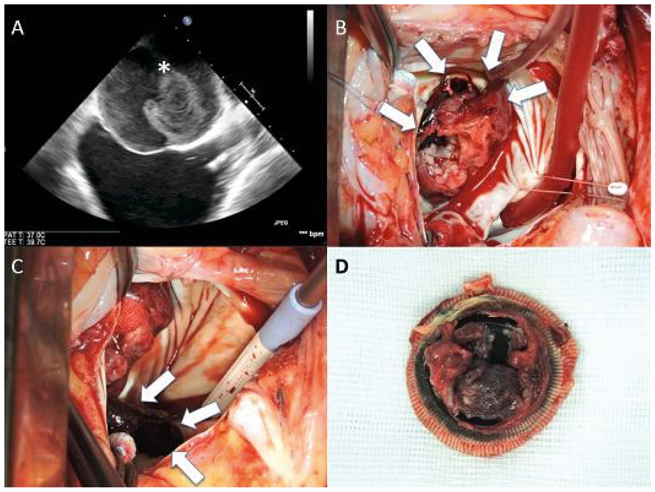 Cardiovascmed 21 00111 i066 Cardiovascmed 21 00111 i066