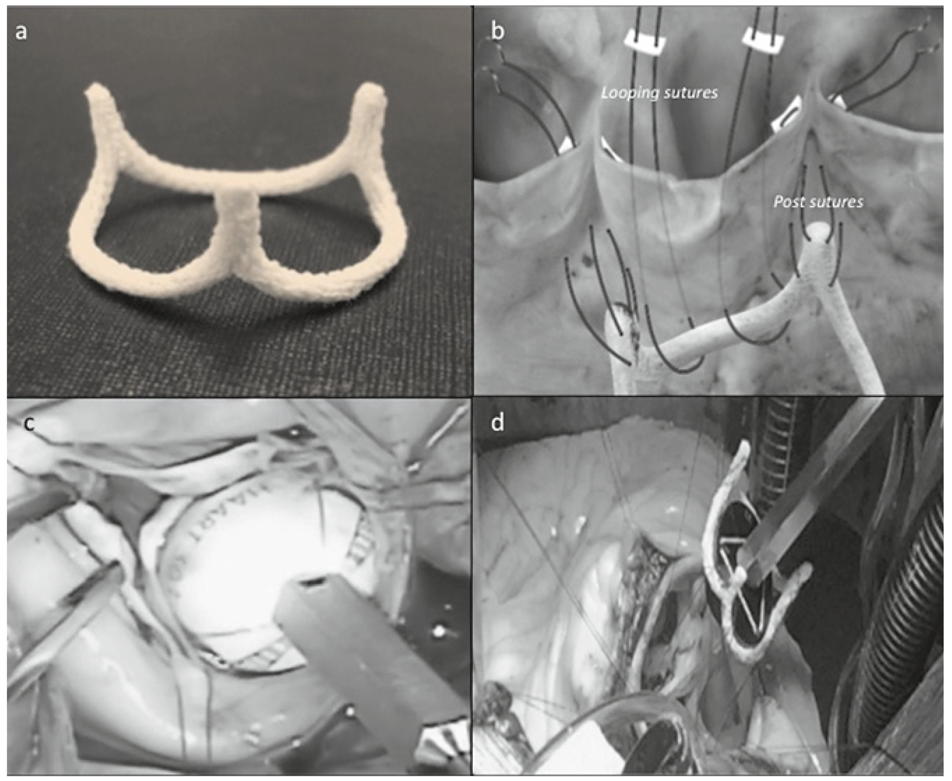 Cardiovascmed 21 00160 g001