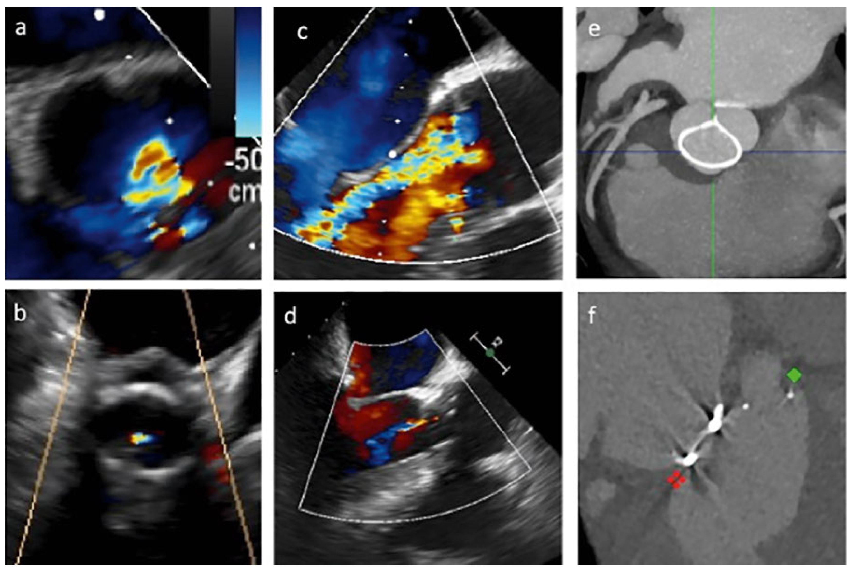 Cardiovascmed 21 00160 g002