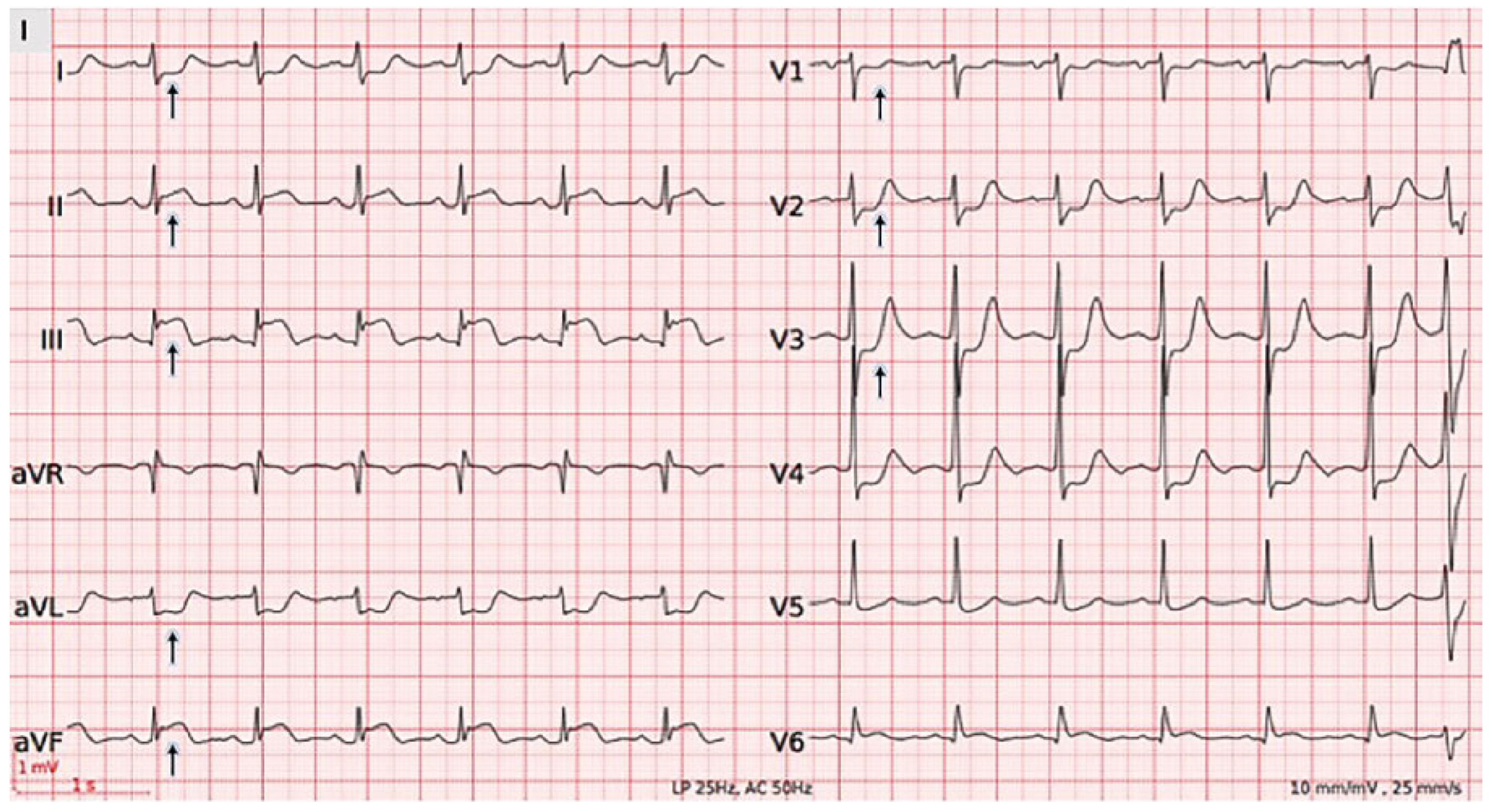 Cardiovascmed 21 00166 g001