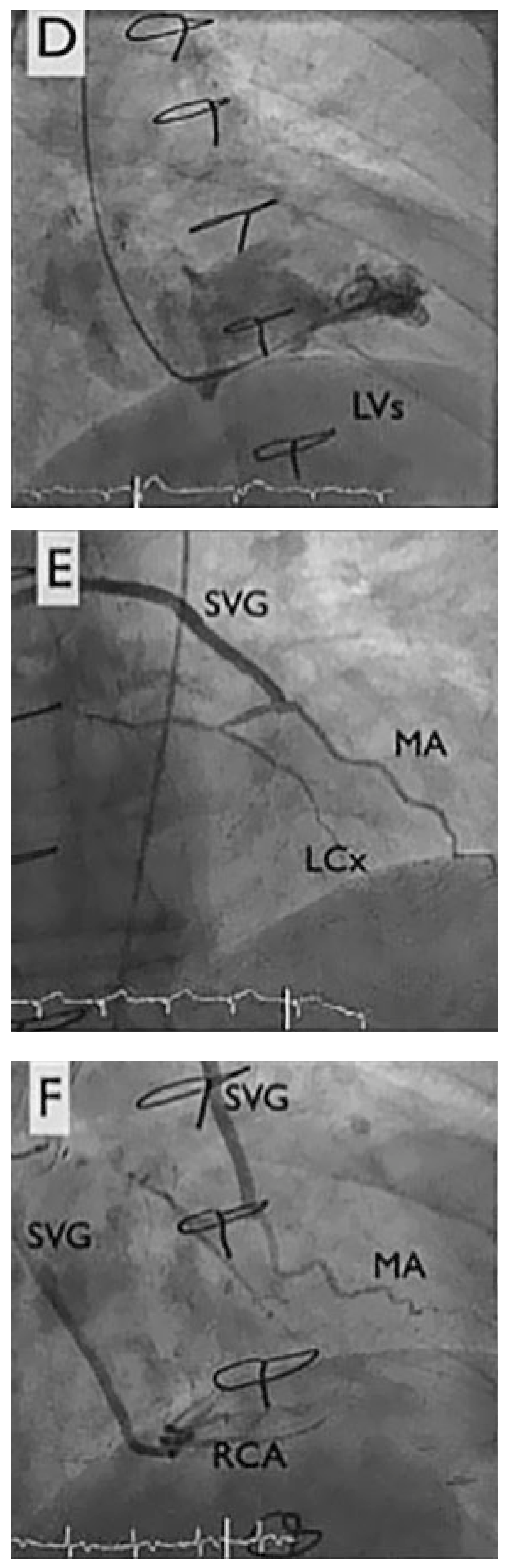 Cardiovascmed 21 00170 g001c